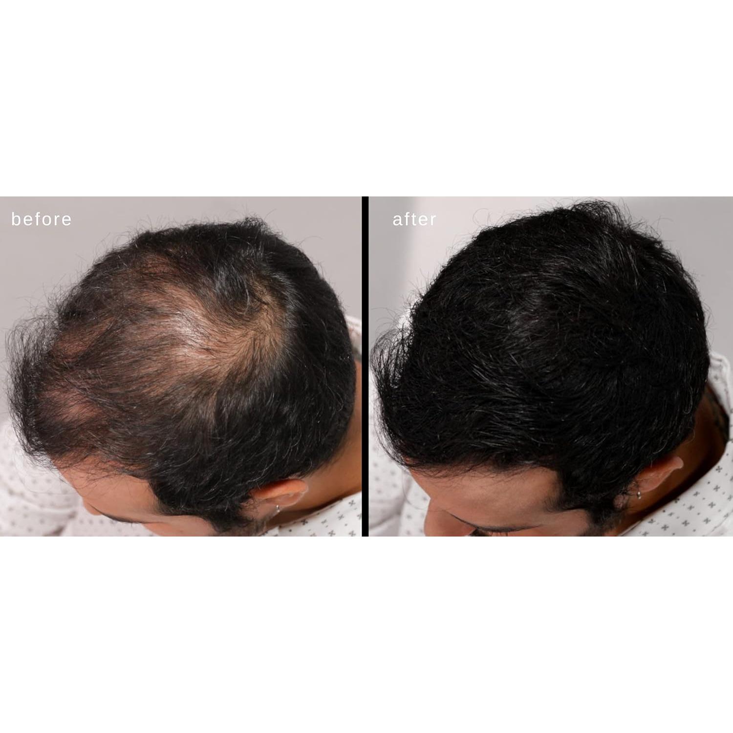 Fibras Engrosadoras para Cabello LUXE 25g Color Negro