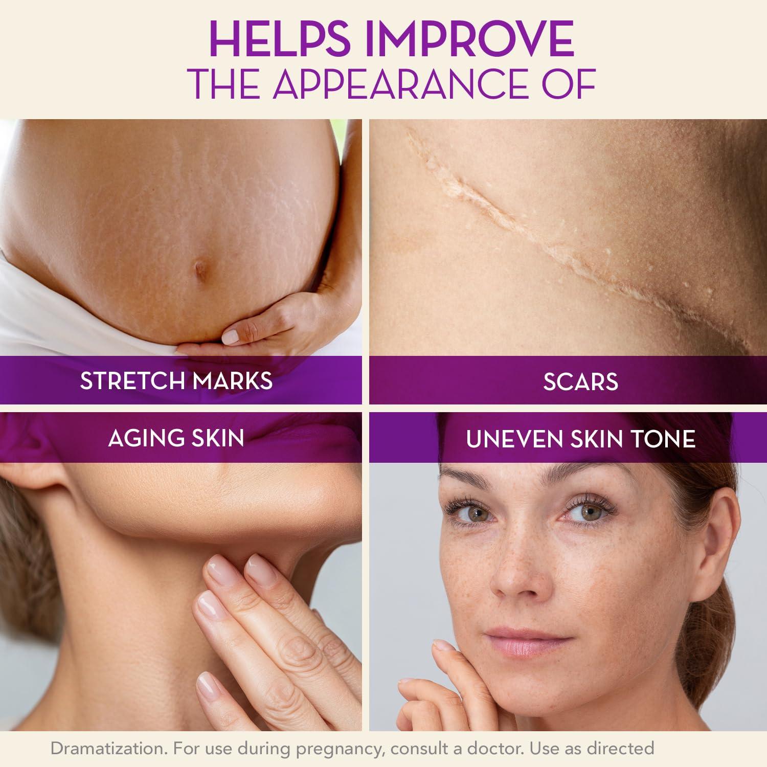 Cicatricure Cica Oil 198 ml - Aceite para Estrías y Cicatrices