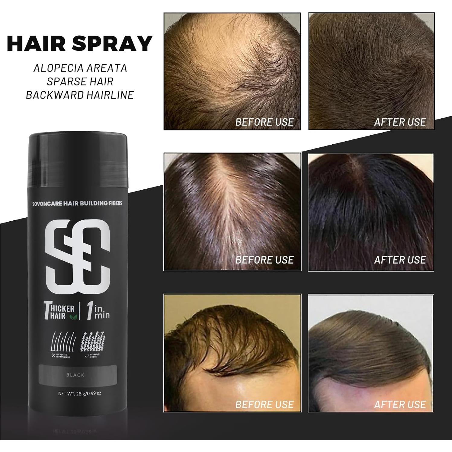 Fibras para Cabello SOVONCARE Negro 28g - Relleno Instantáneo