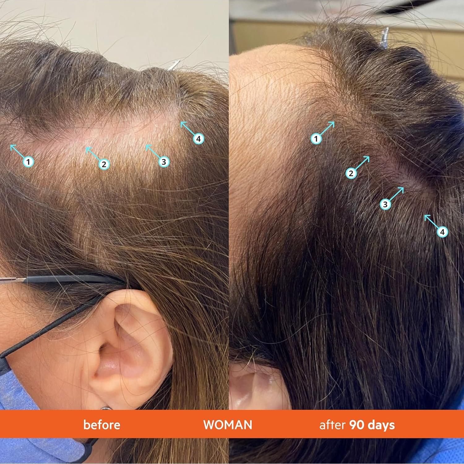 Kit de Champú y Acondicionador Revita DS Labs 205 mL - Cuidado Cuero Cabelludo