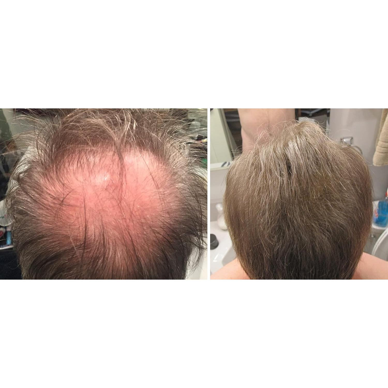 Caboki Fibra para Cabello Natural 30g Marrón Medio