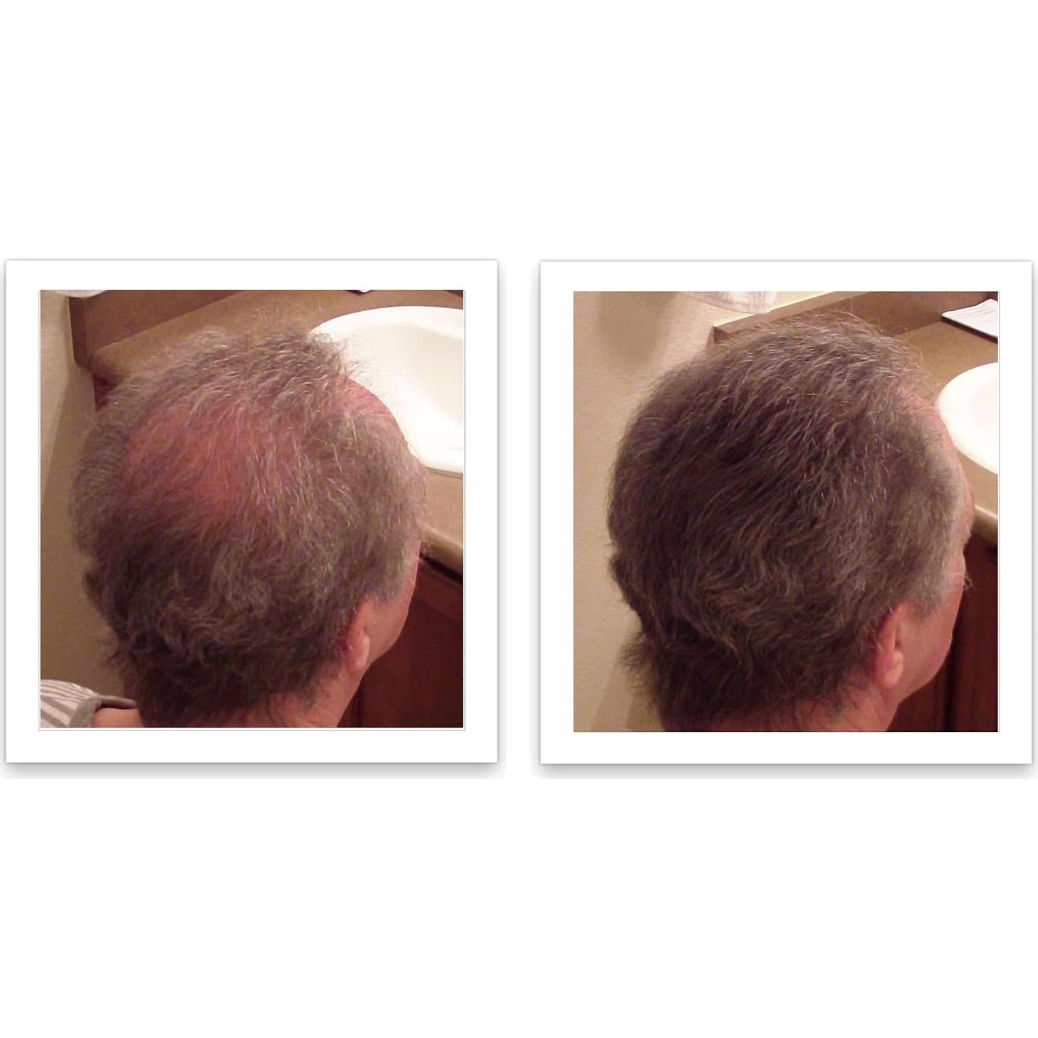 Caboki Fibra para Cabello Natural 30g Marrón Medio