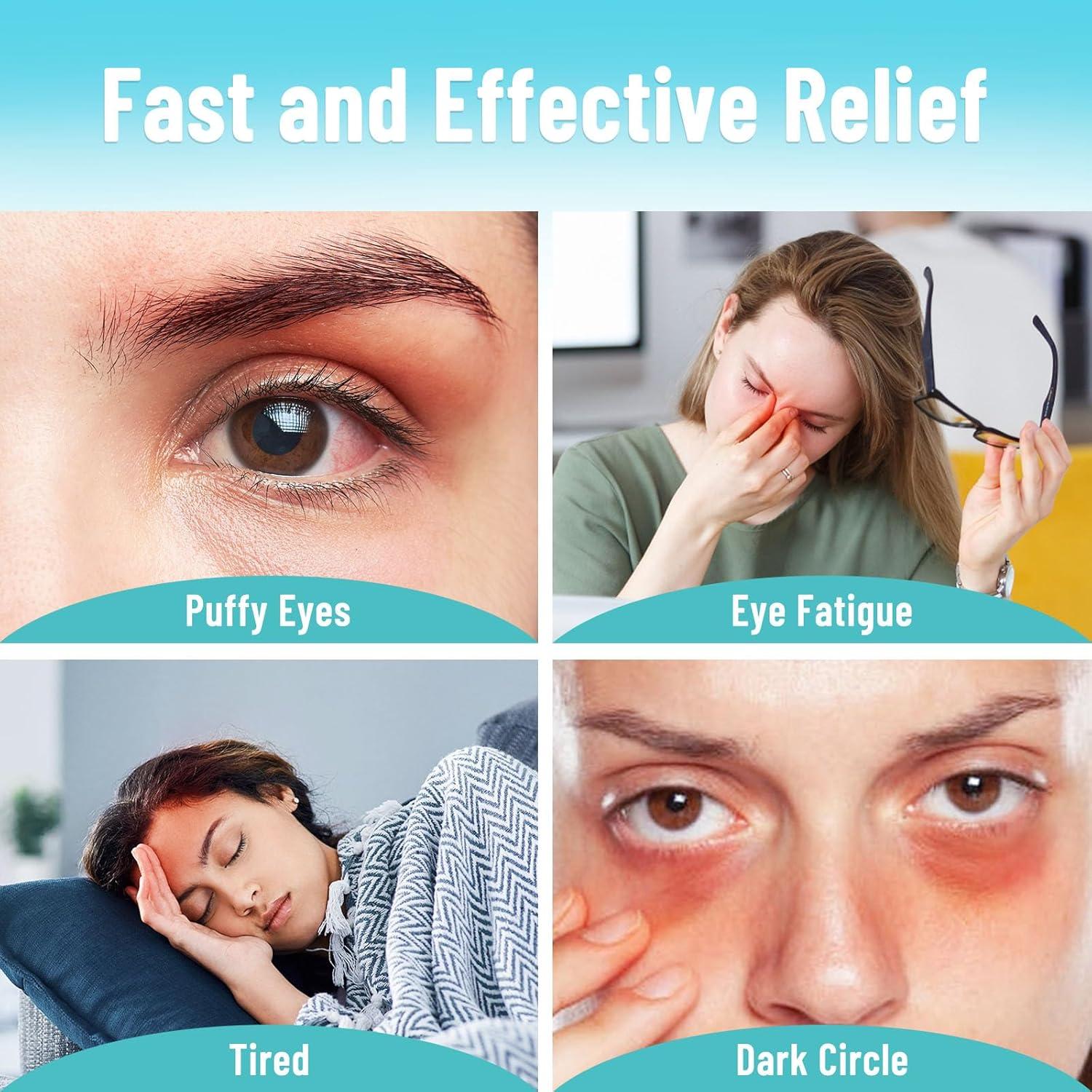 Máscara de Ojos Fría de Gel 3D ATreebay - Alivio Ojeras 24.8x9.3 cm