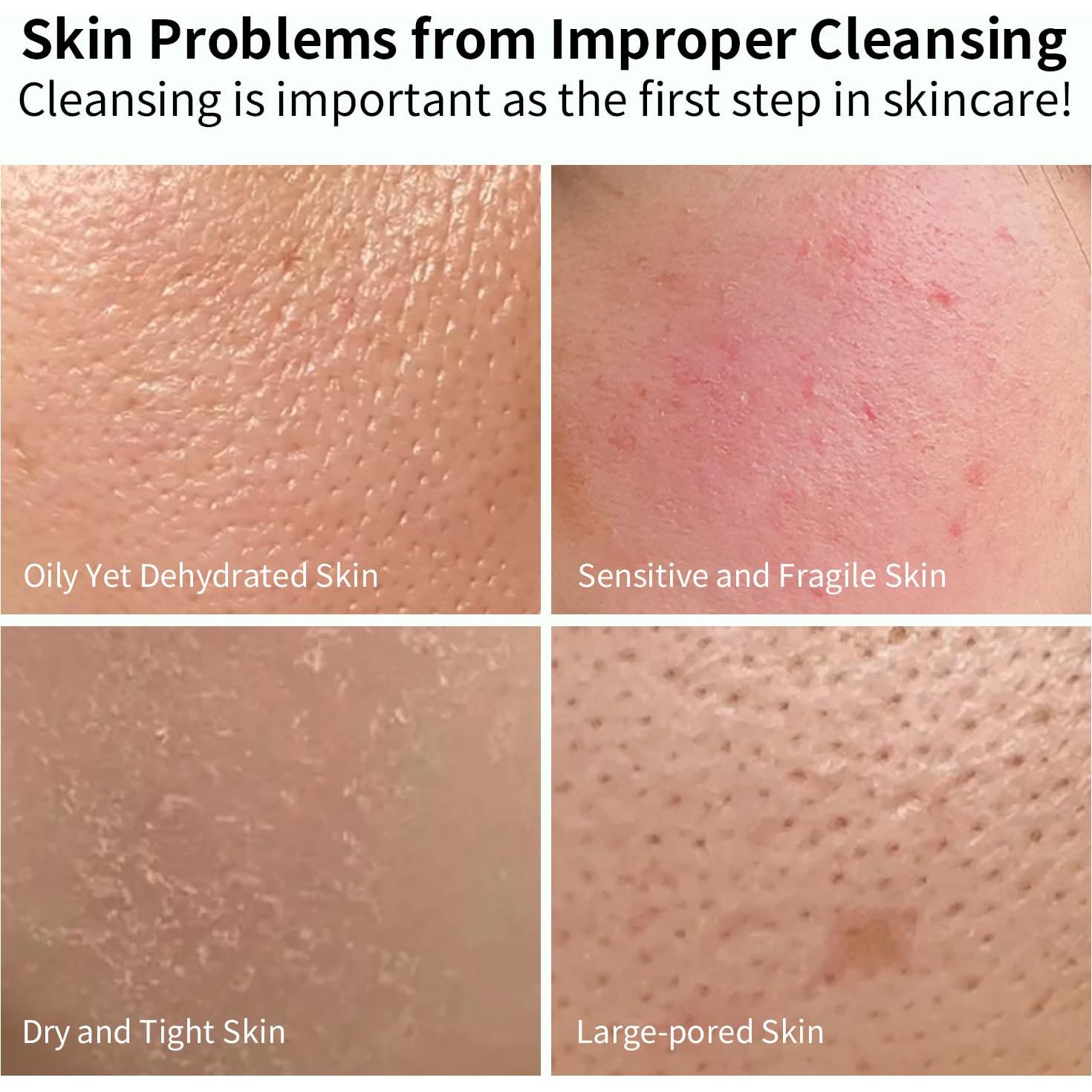 Limpiador Facial Espumoso Missedsen 283.5 ml Piel Grasa Acné