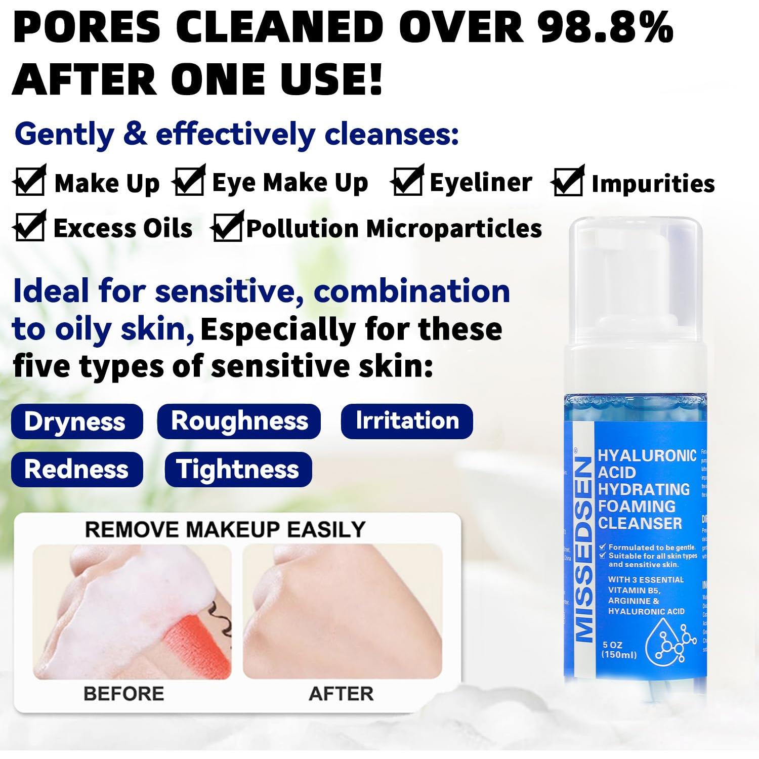 Limpiador Facial Espumoso Missedsen 283.5 ml Piel Grasa Acné