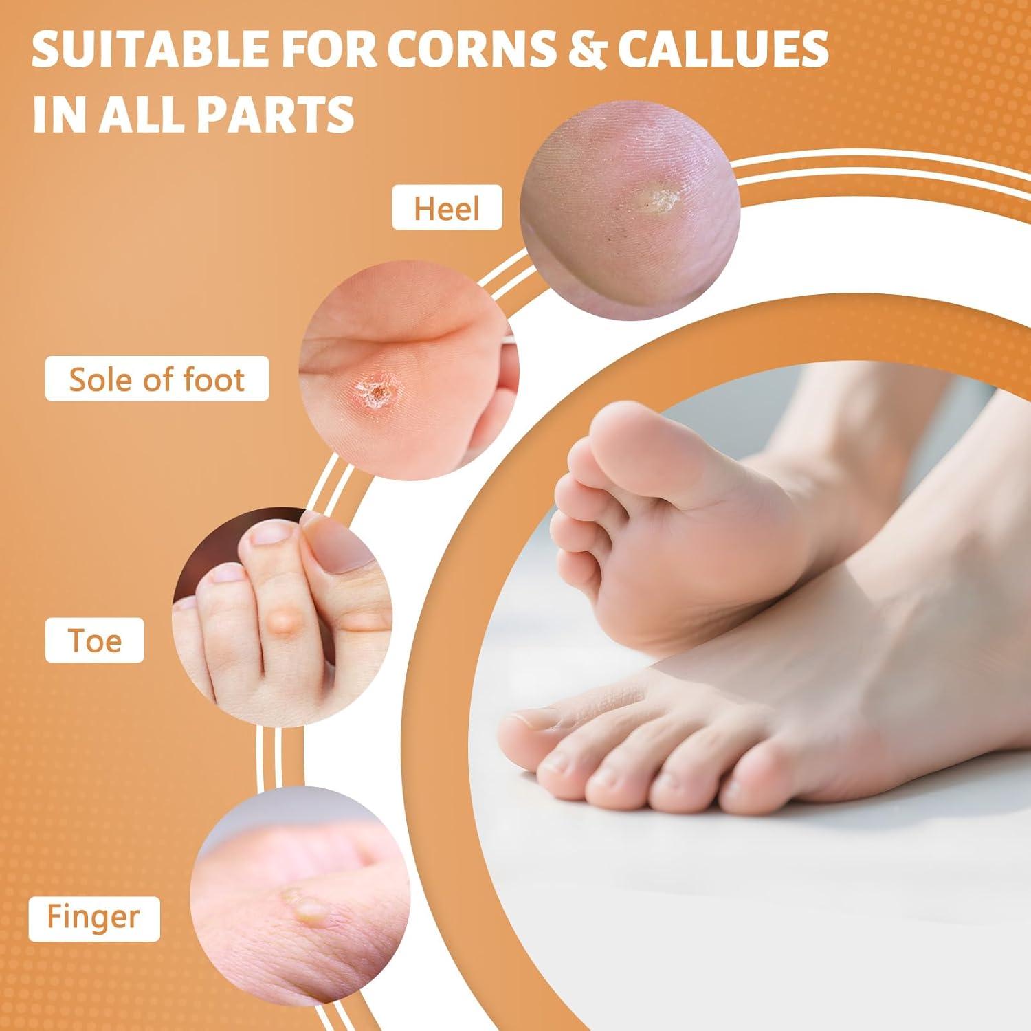 Parches Removedores de Callos AEE - 30 Parches 40% Ácido Salicílico