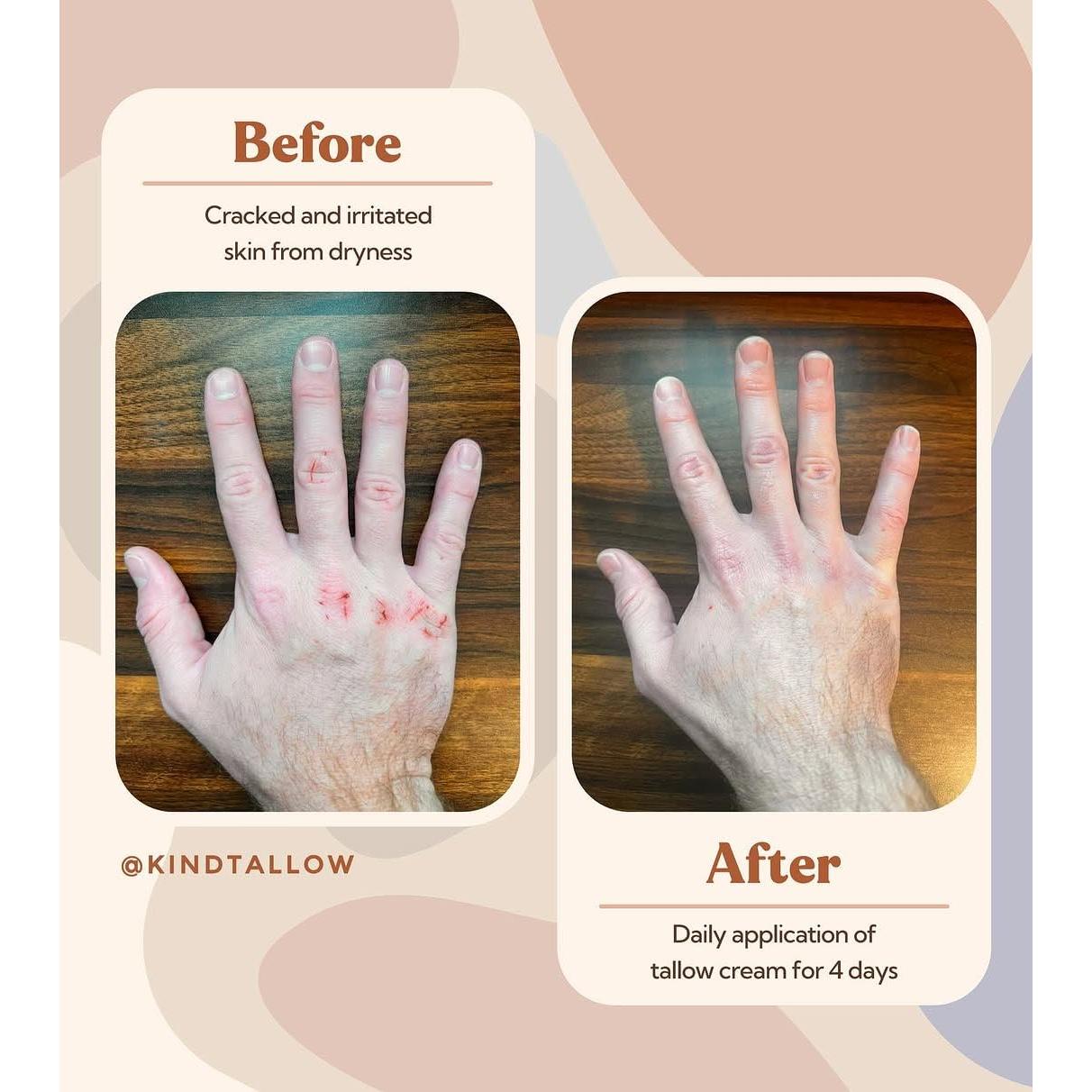 Grasa de Res Orgánica KindTallow - Hidratante Facial 3x56.7g