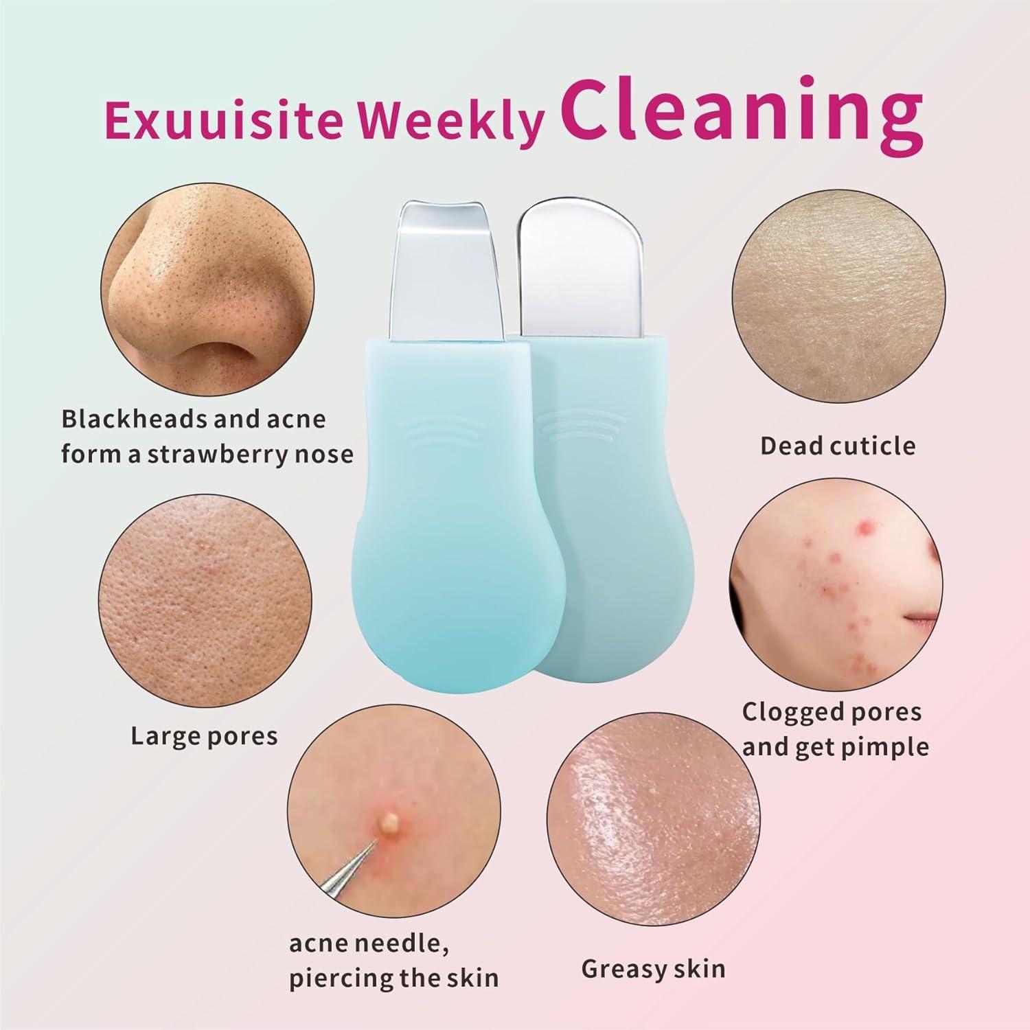 Juego de Herramientas de Belleza REVEX para Puntos Negros 2 Pzas