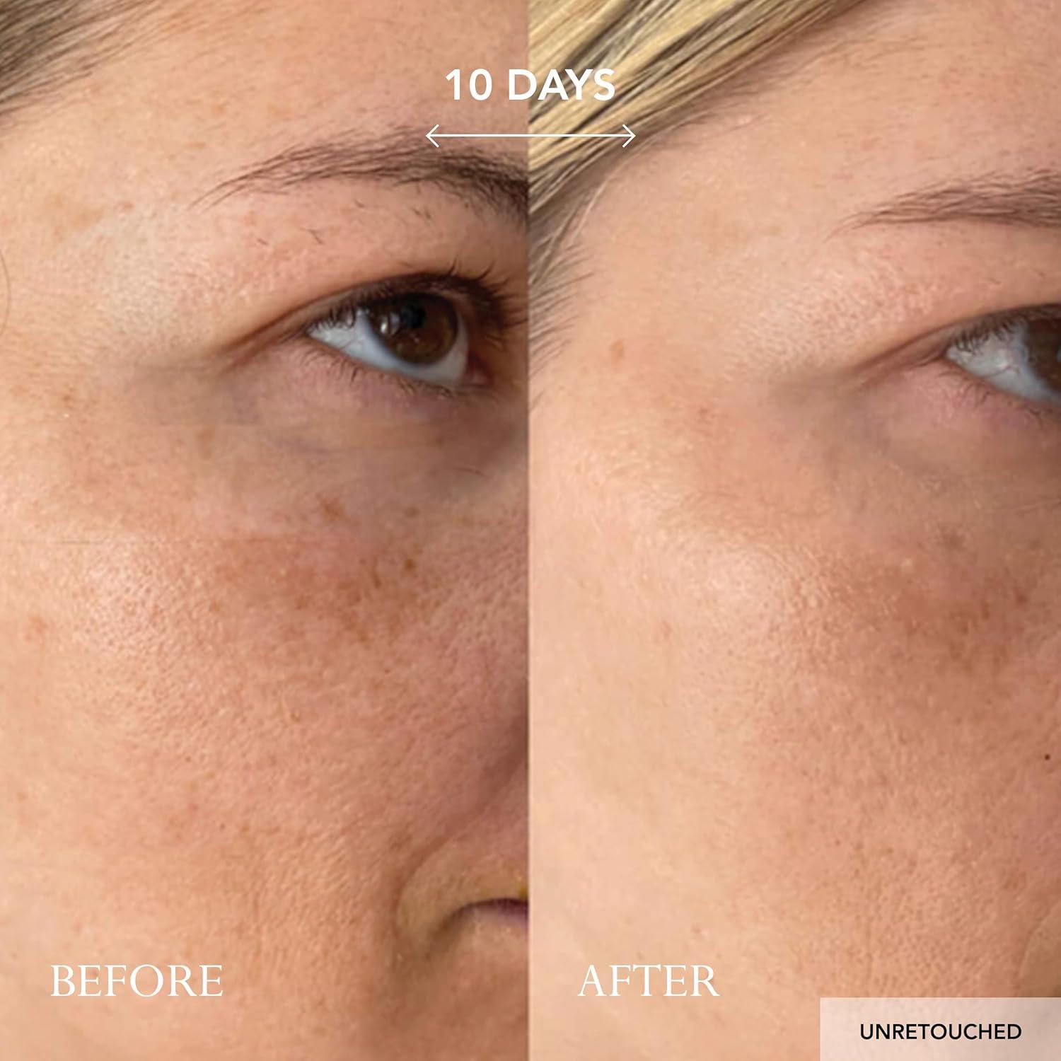 Crema Facial Intensiva KAT BURKI Vitamina C 15% 29.57 ml