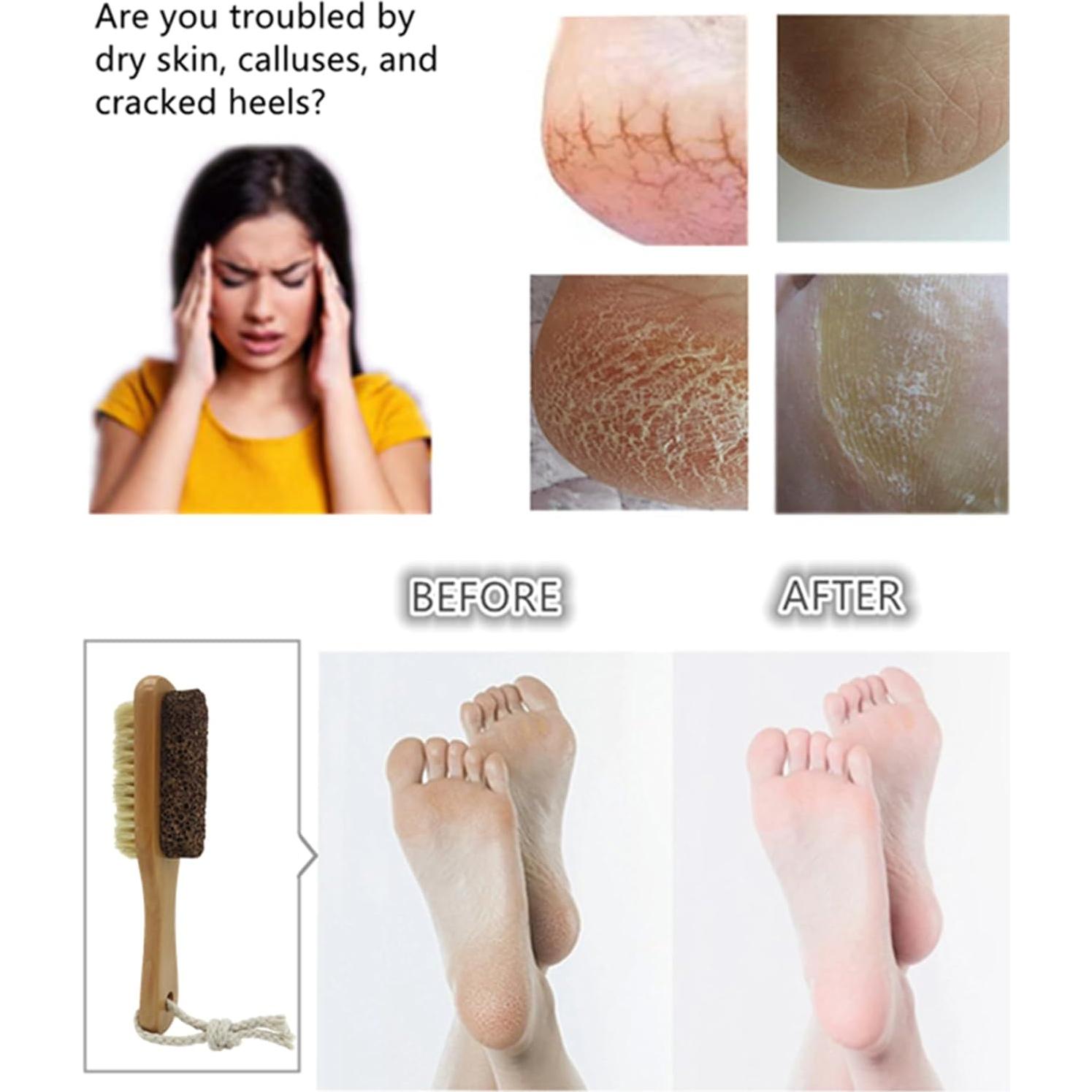 Set de Pedicura YIOYOODA con Piedra Pómez y Cepillo de Jabalí