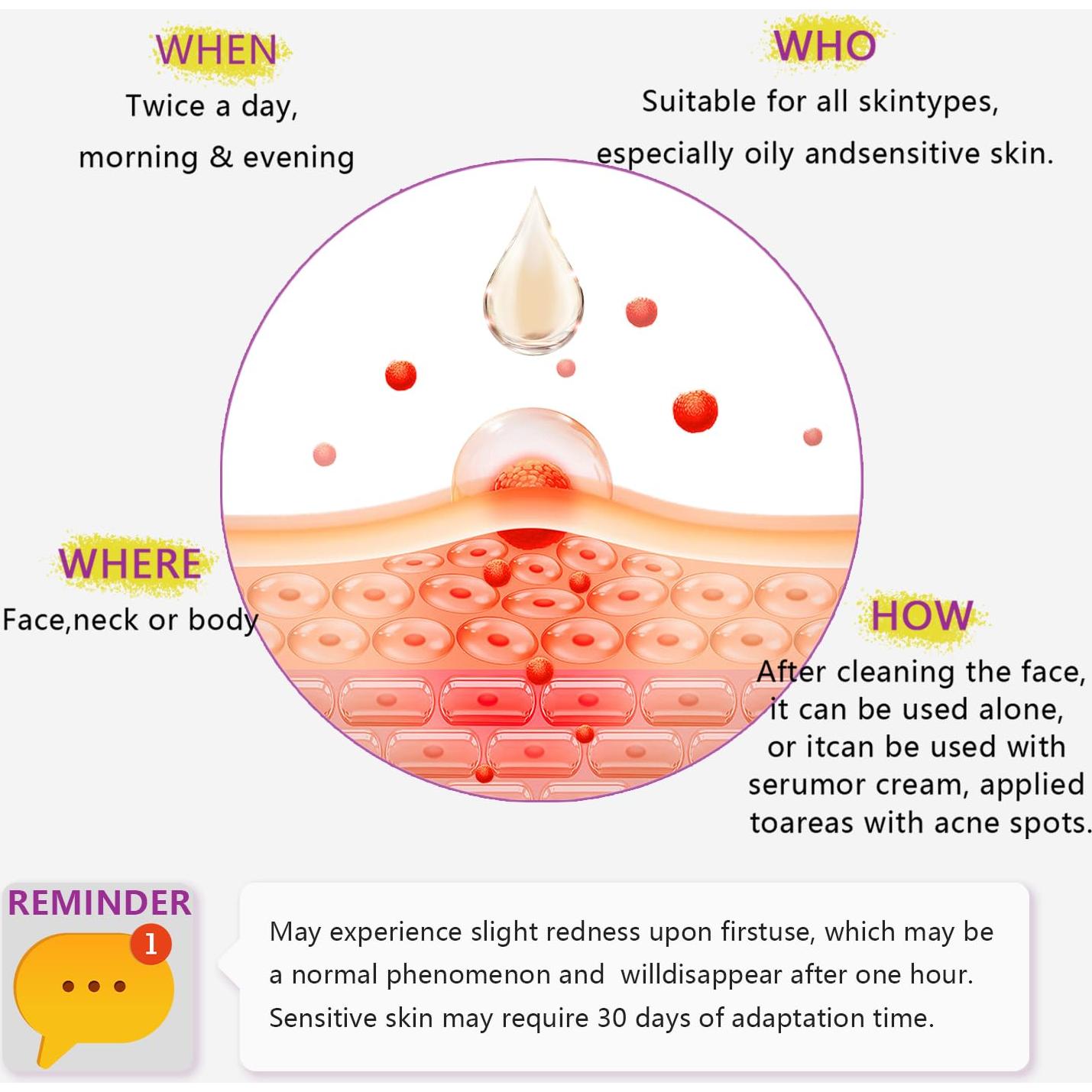 Suero Facial Ácido Azelaico 12% RIGBOO - Niacinamida y Ácido Hialurónico