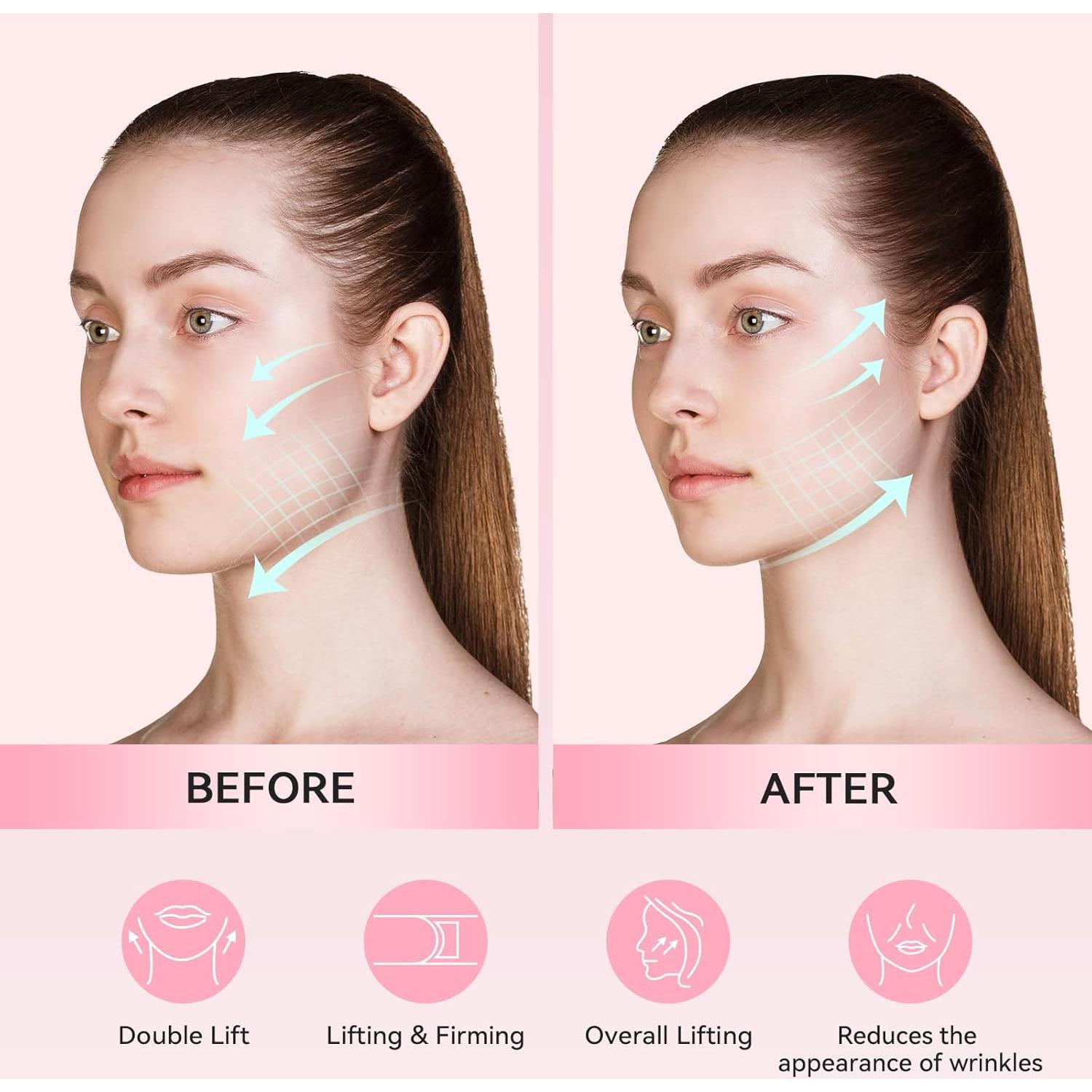 Correa Reutilizable para Adelgazar la Cara - Soporte Mandíbula