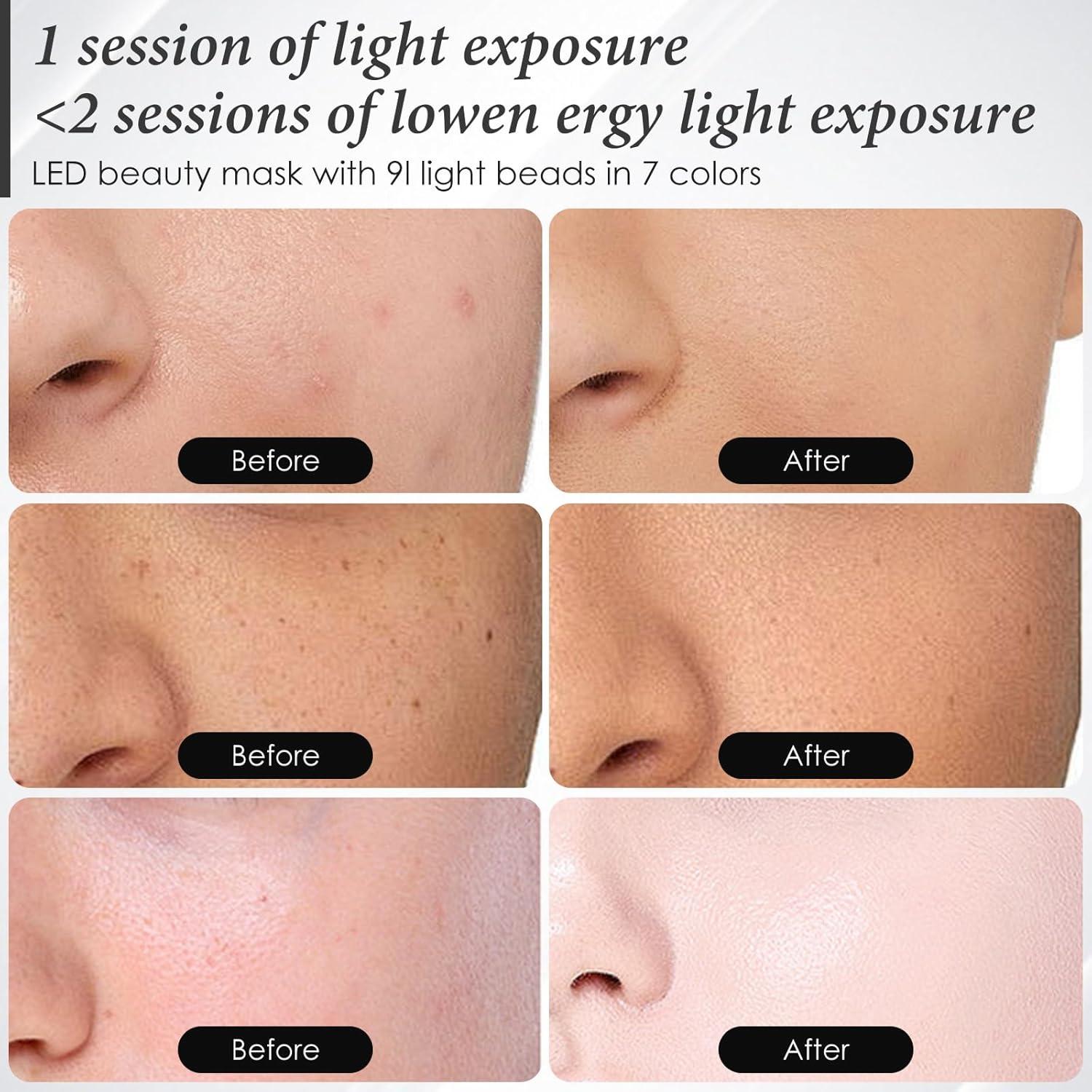 Máscara Facial de Luz Roja SDKWDH 7 Colores Ergonómica