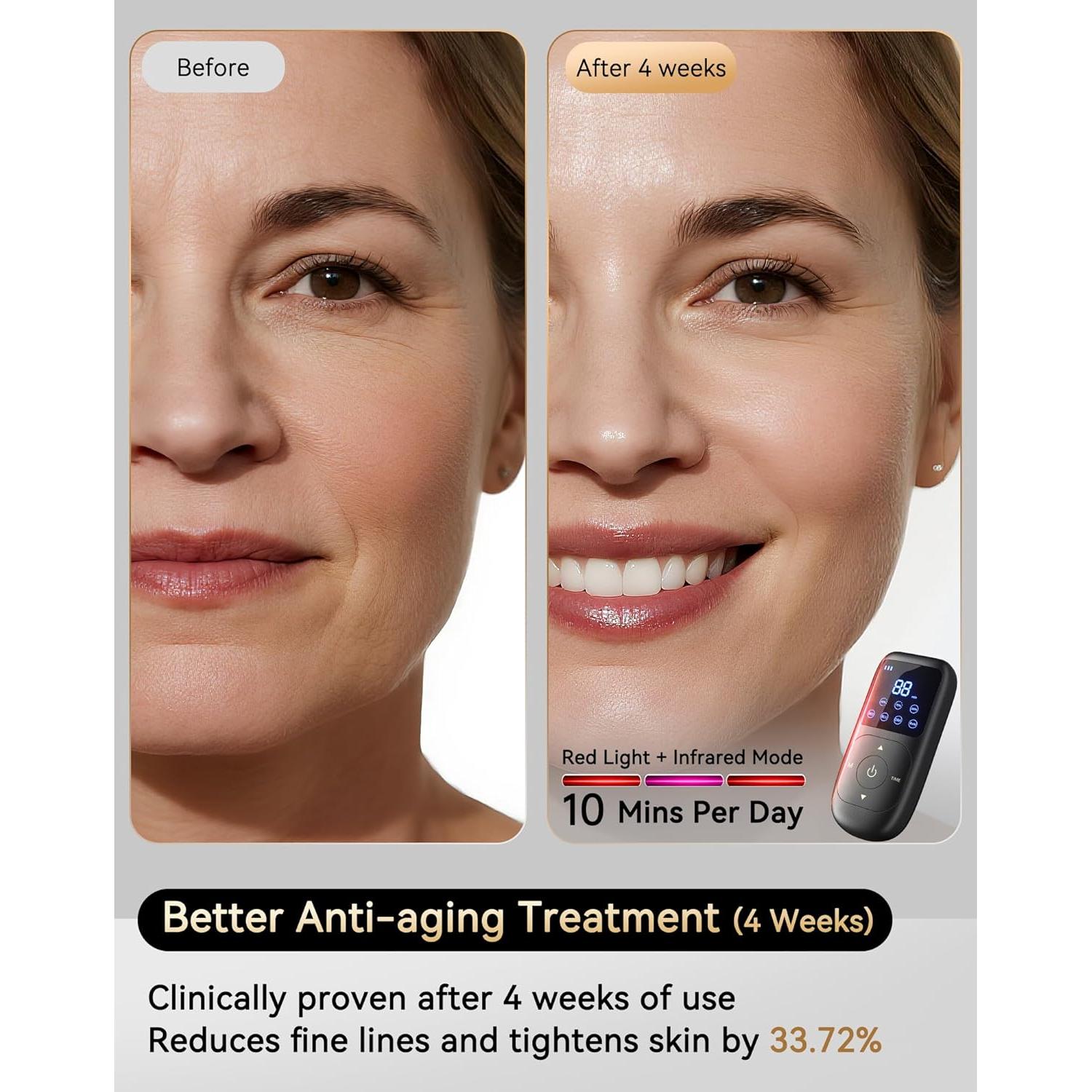 Máscara Facial LED 4D iQLED Terapia de Luz Roja 625nm