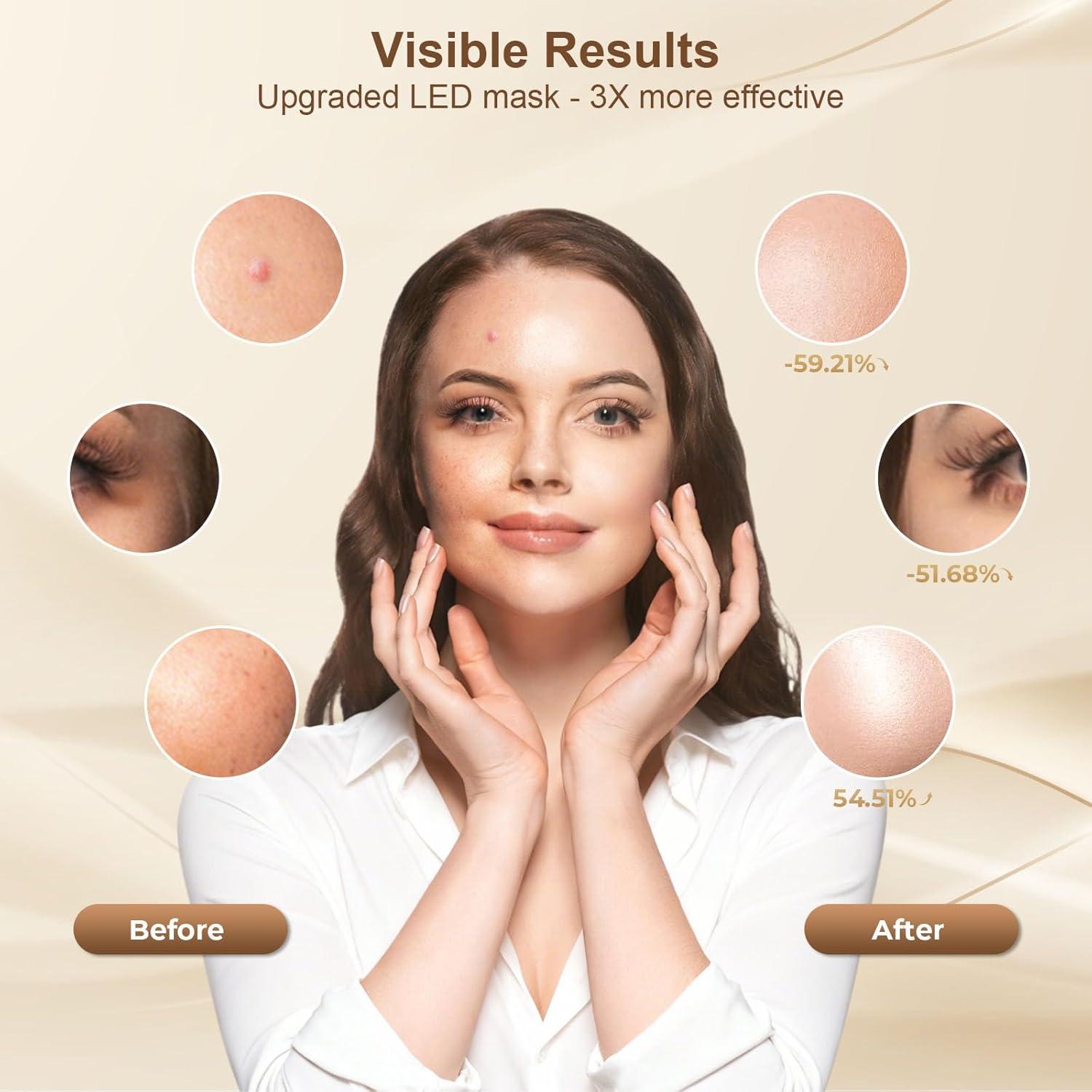 Máscara de Terapia de Luz Roja AIUO FM-01 LED Recargable