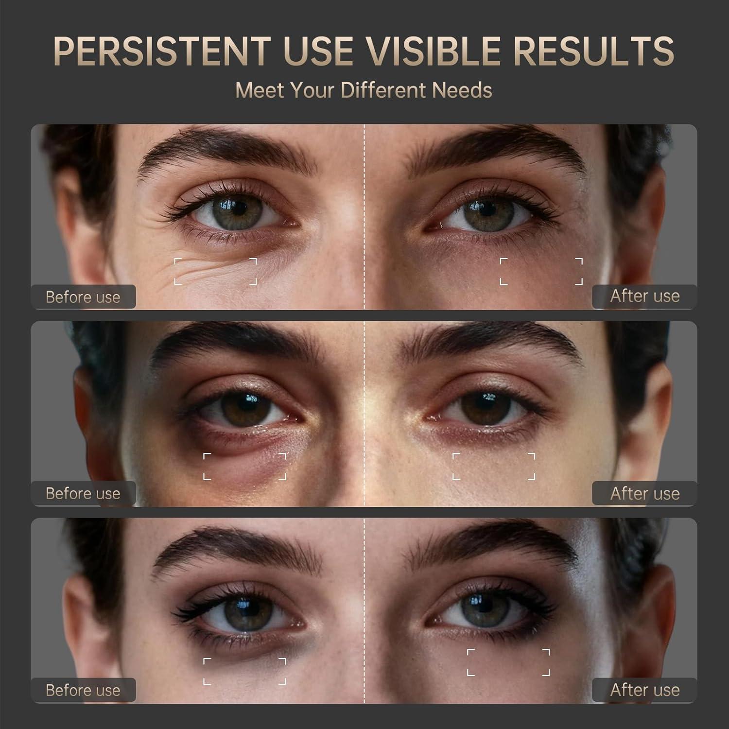 Máscara de Luz Roja Amifiy para Ojos - Anti-Ojeras y Arrugas