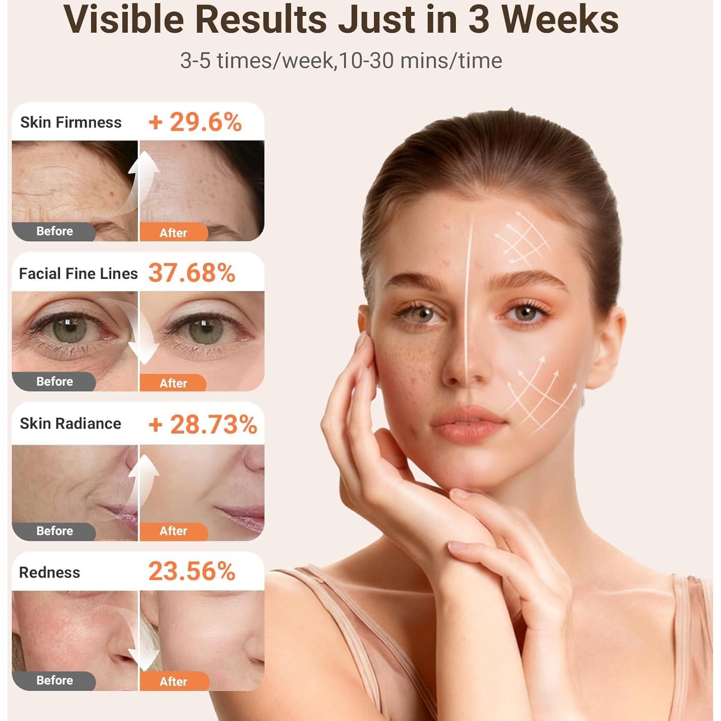 Máscara Facial LED Terapia de Luz Roja y Azul 256 LEDs