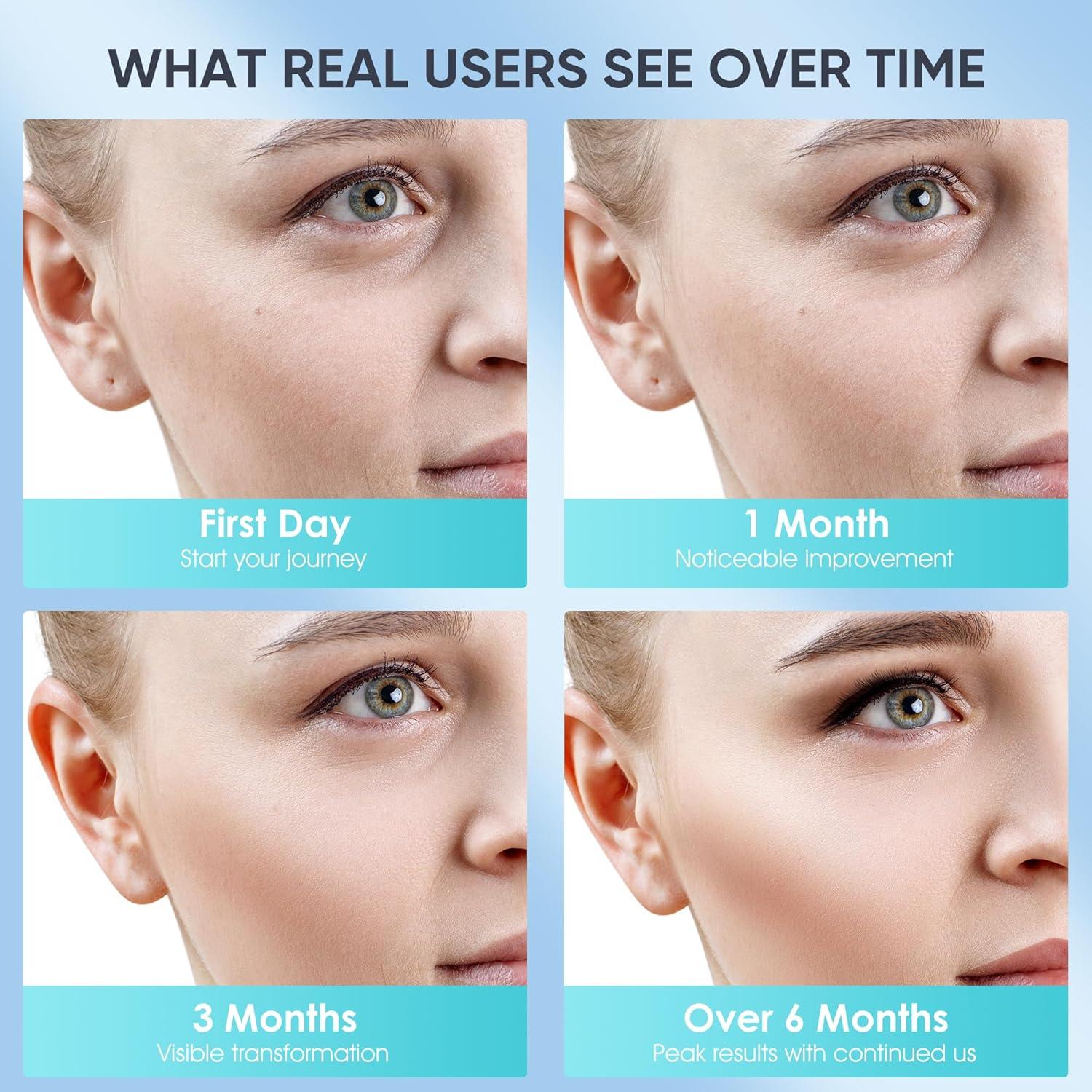 Máscara Facial LED WEETALL con Enfriamiento - 4 Modos de Luz