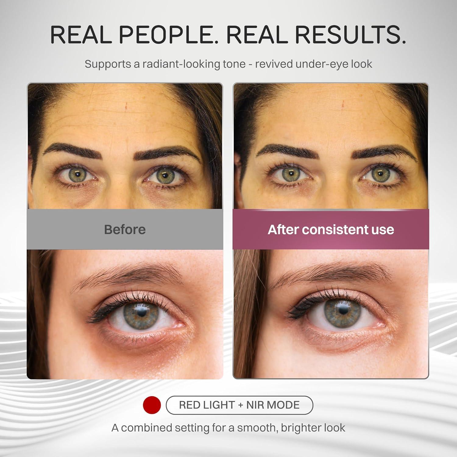 Mascarilla LED Numiere Time Keeper - Cuidado Facial Rojo, Azul y NIR