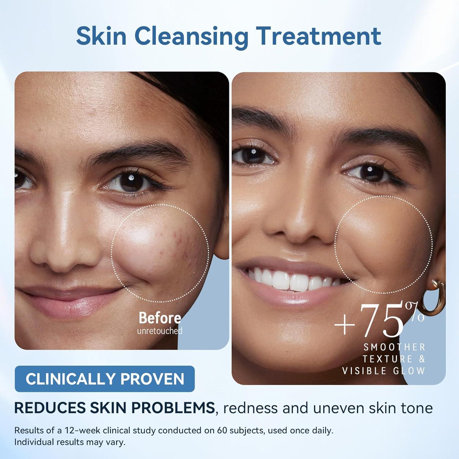 Máscara de Terapia de Luz LED FOLOKE MK66R-B Cuidado Facial