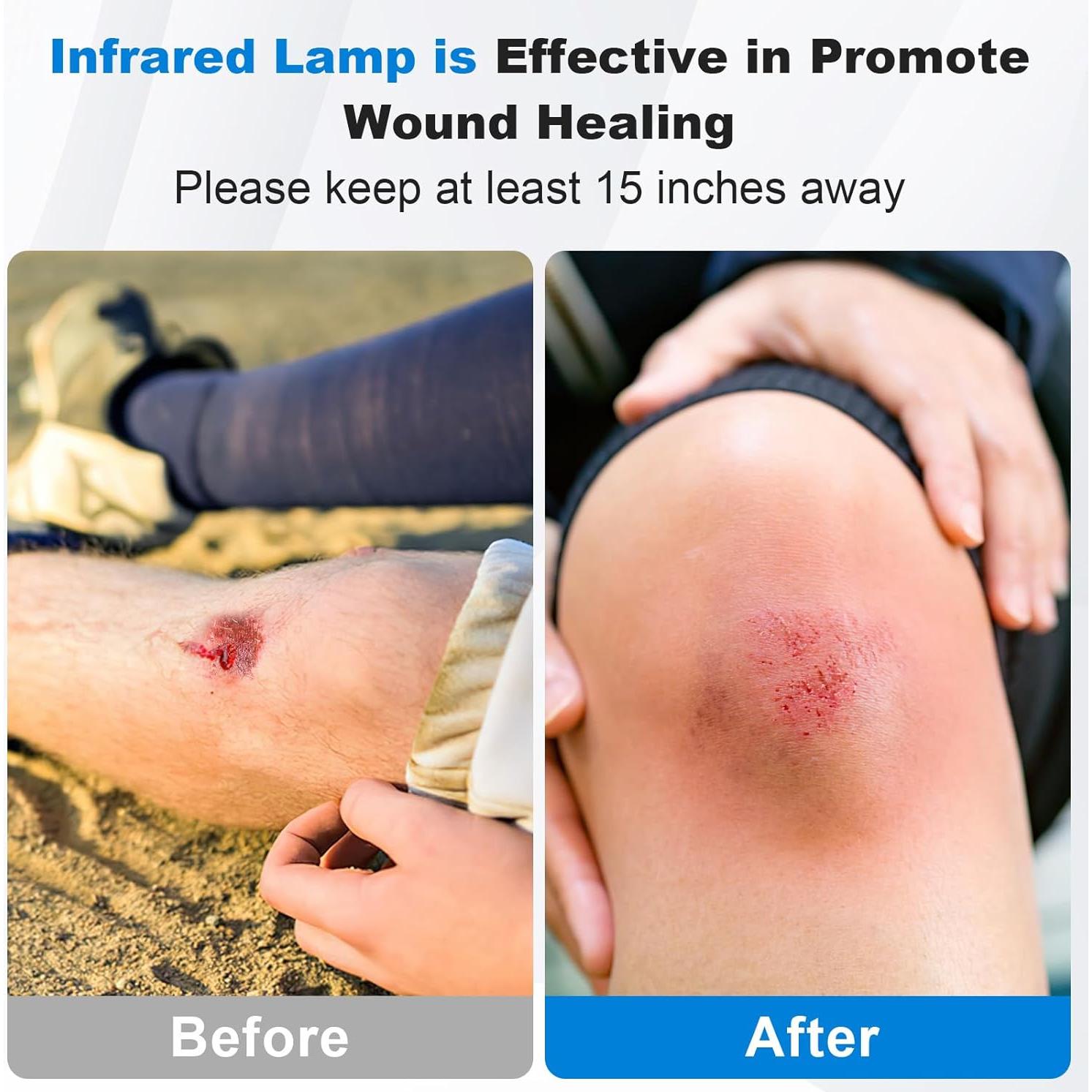 Lámpara de Terapia de Luz Roja Profey 150W Ajustable 21.6x21.6x61cm