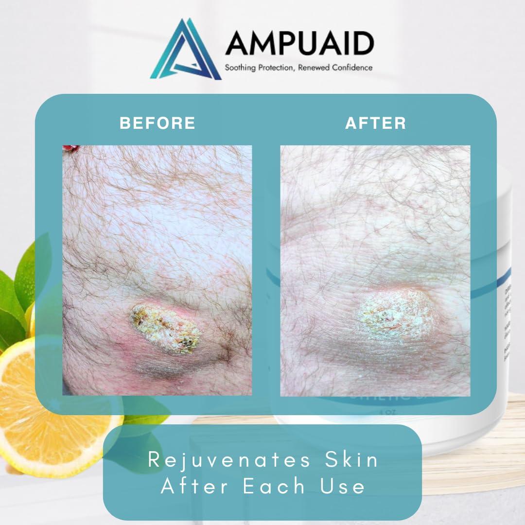 Ungüento Prostético AmpuAid 100g - Hidratante y Calmante