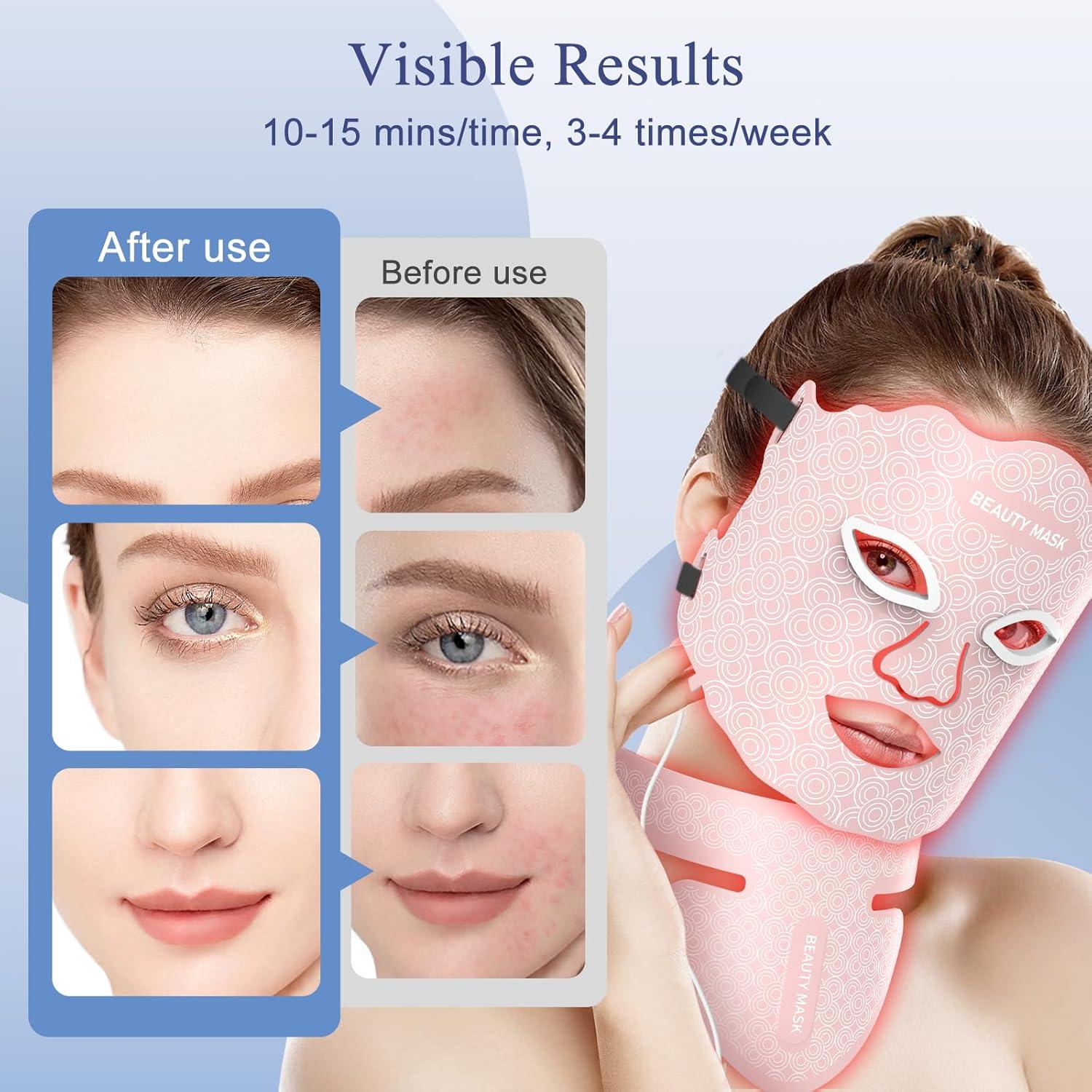 Máscara de Terapia de Luz LED Rosa para Cara y Cuello