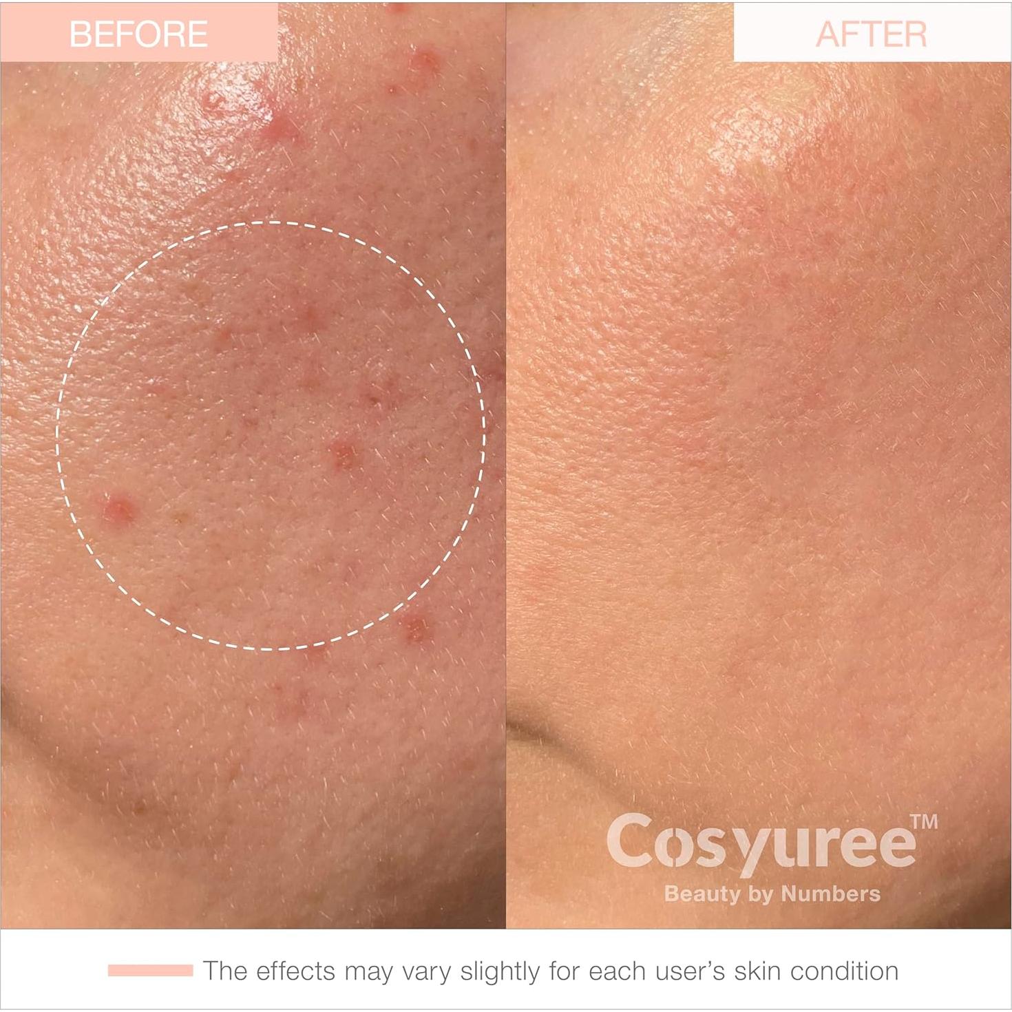 Mascarilla Hidrogel Colágeno Cosyuree 34g x 5ea Hidratante