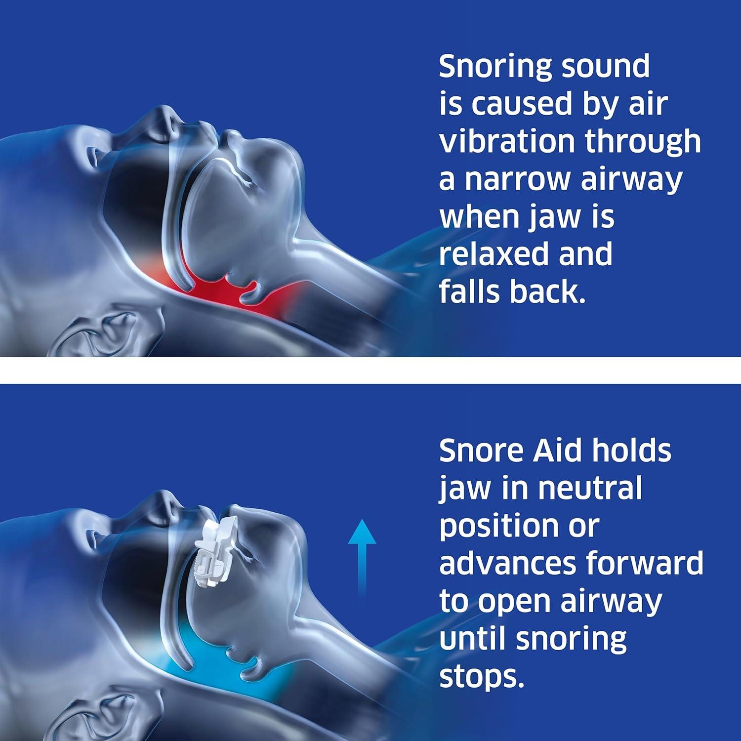 Dispositivo Antirronquidos SleepRight - Ajustable y Cómodo
