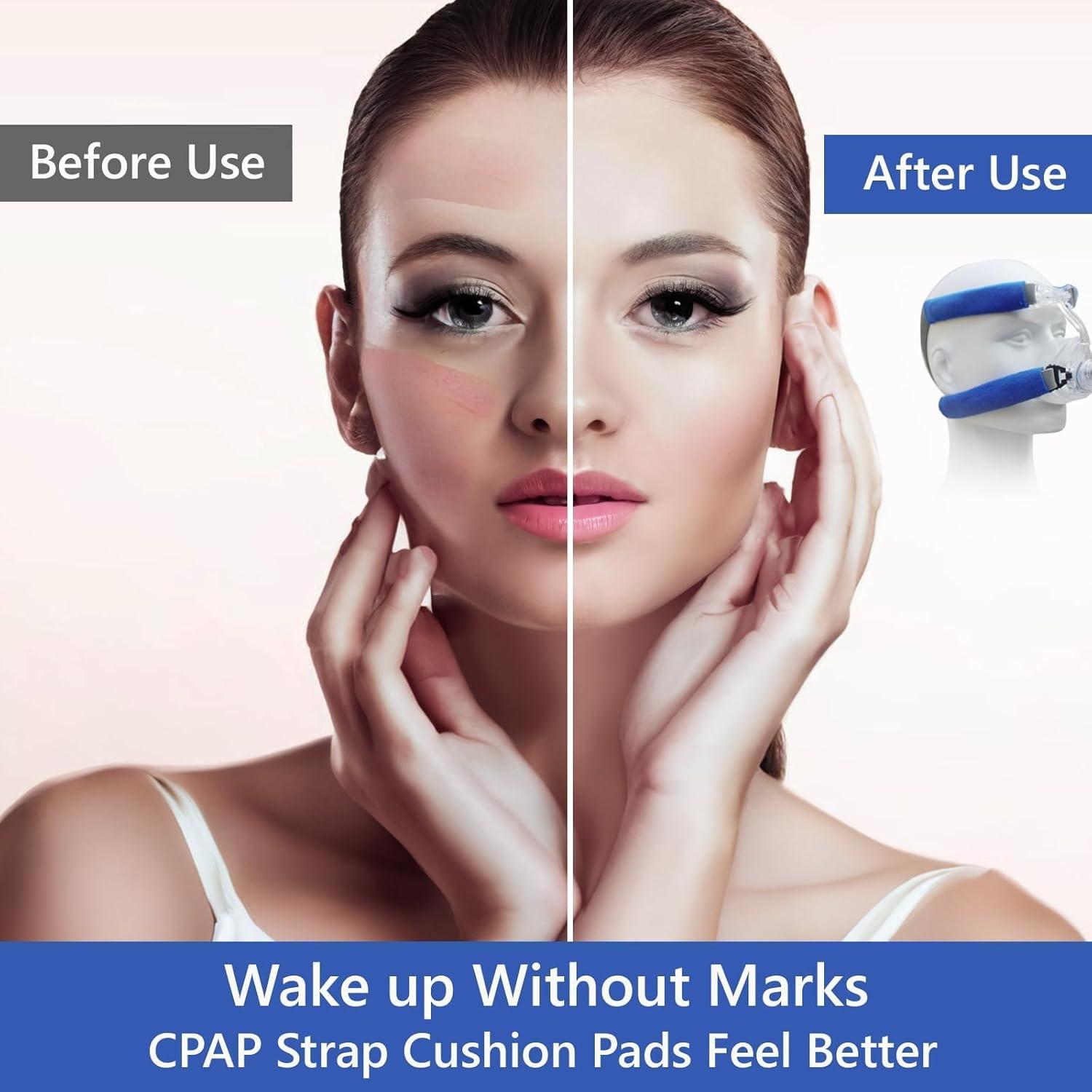 Paquete de 8 Almohadillas de Confort para Correas de CPAP LONYEON