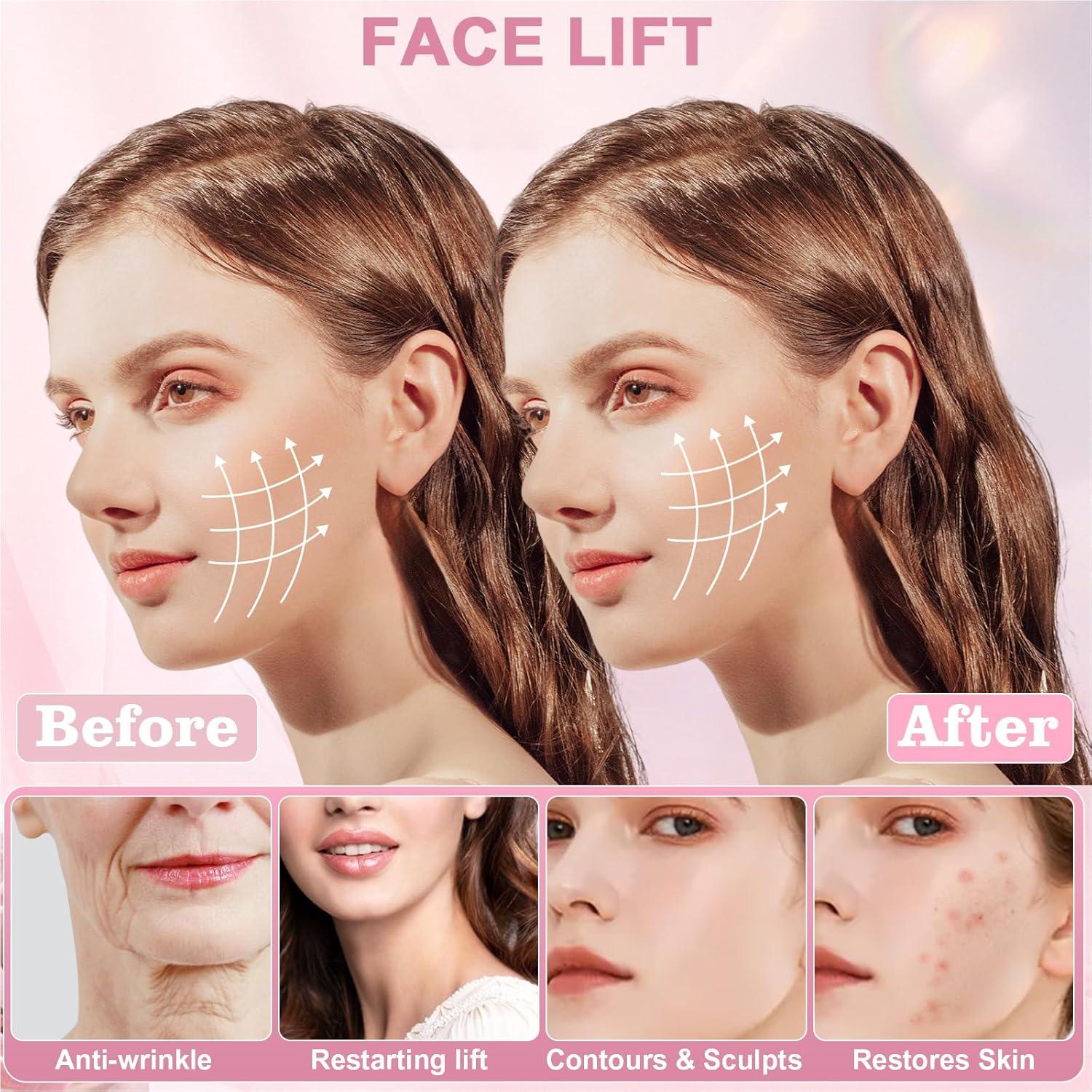 Correa para Barbilla Anti Ronquidos YZWONLY Rosa Ajustable