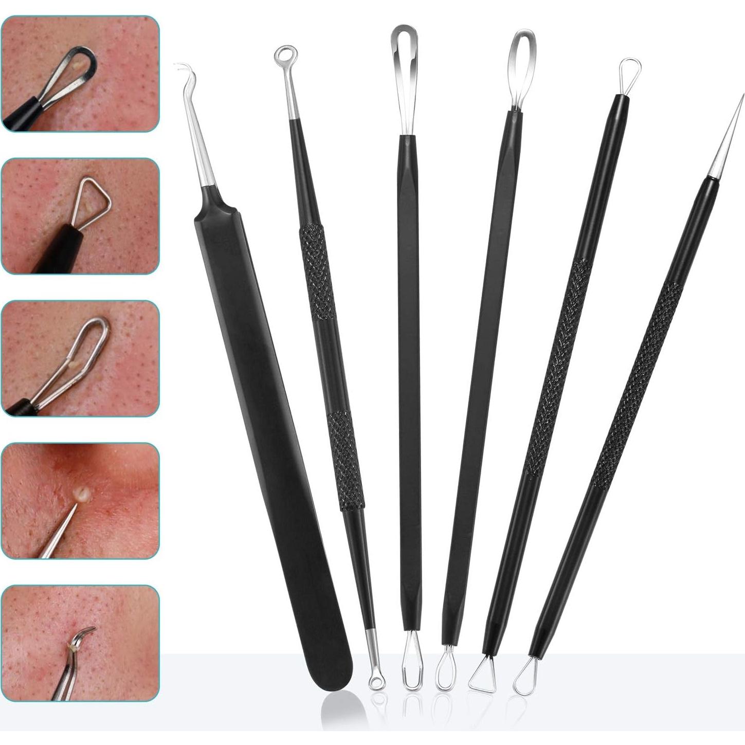 Kit de Herramientas Extractoras de Puntos Negros Tomata - 6 Piezas Acero Inoxidable