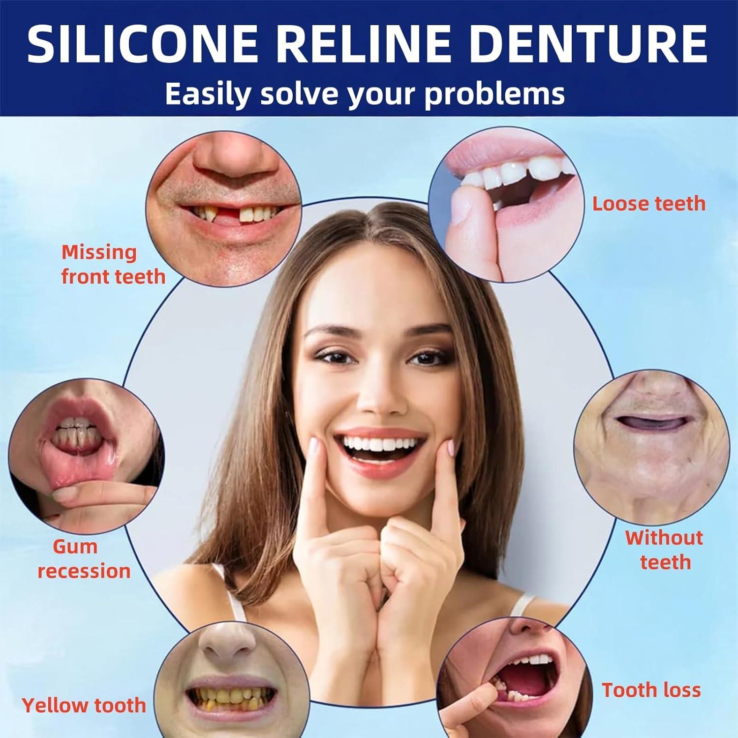 Forros de Dentadura de Silicona Suave Xinshijie - Ajuste Seguro