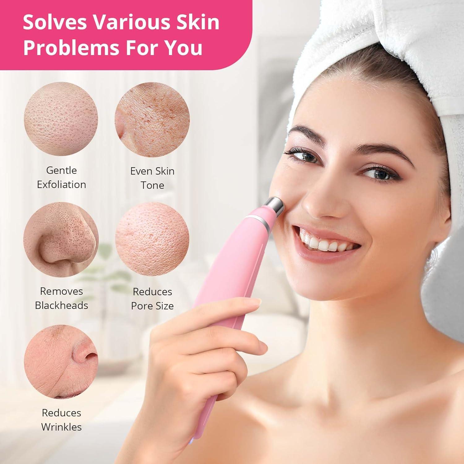 Máquina de Microdermoabrasi&oacute;n UNOISETION Rosa Portátil 12 Puntas