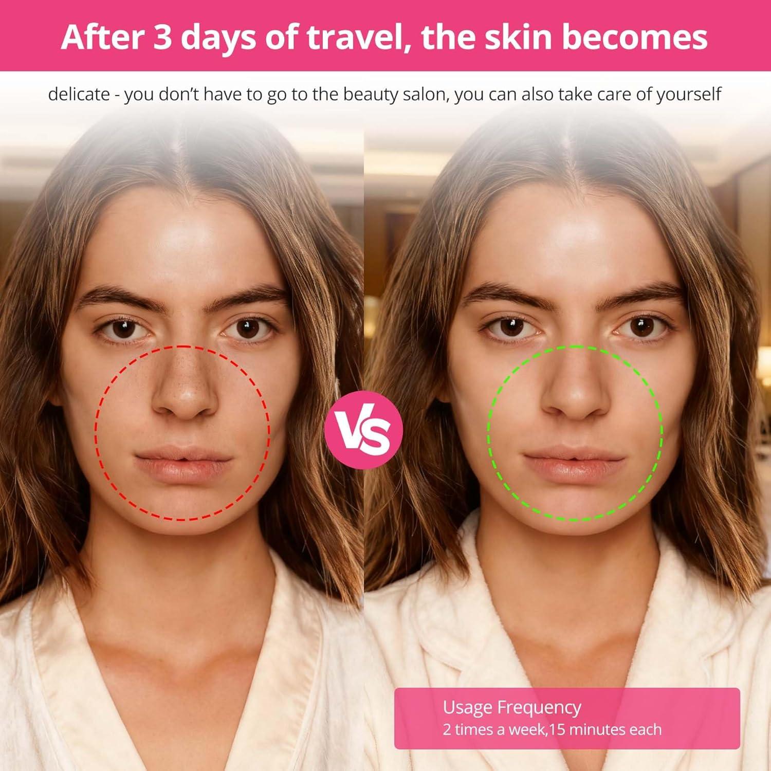 Máquina de Microdermoabrasi&oacute;n UNOISETION Rosa Portátil 12 Puntas