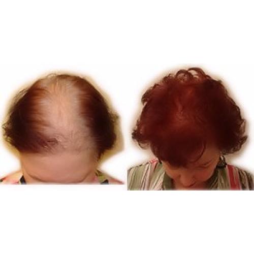 Relleno de Fibra Capilar 250g Finalmente Cabello Gris Claro