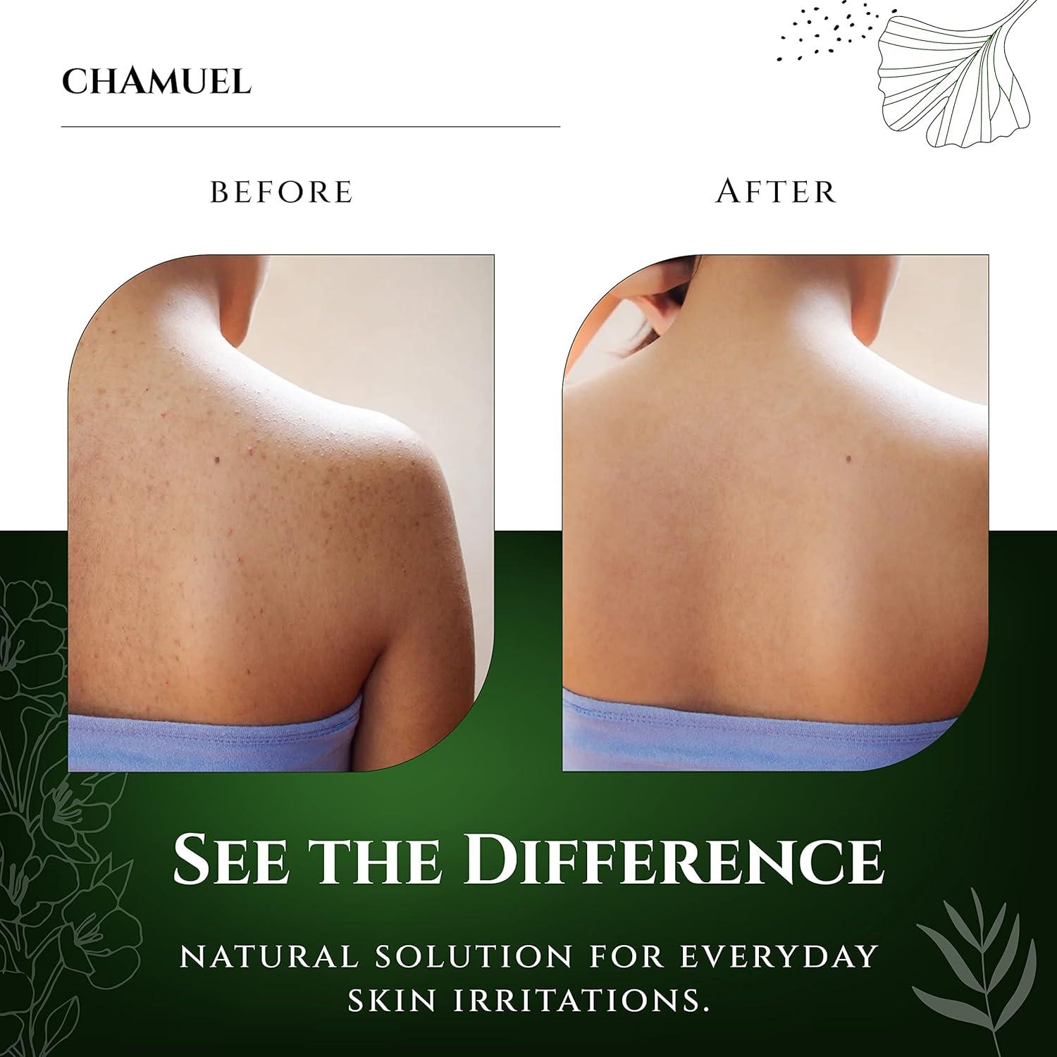 Champú Corporal Natural Chamuel - Árbol de Té 334.5g x2