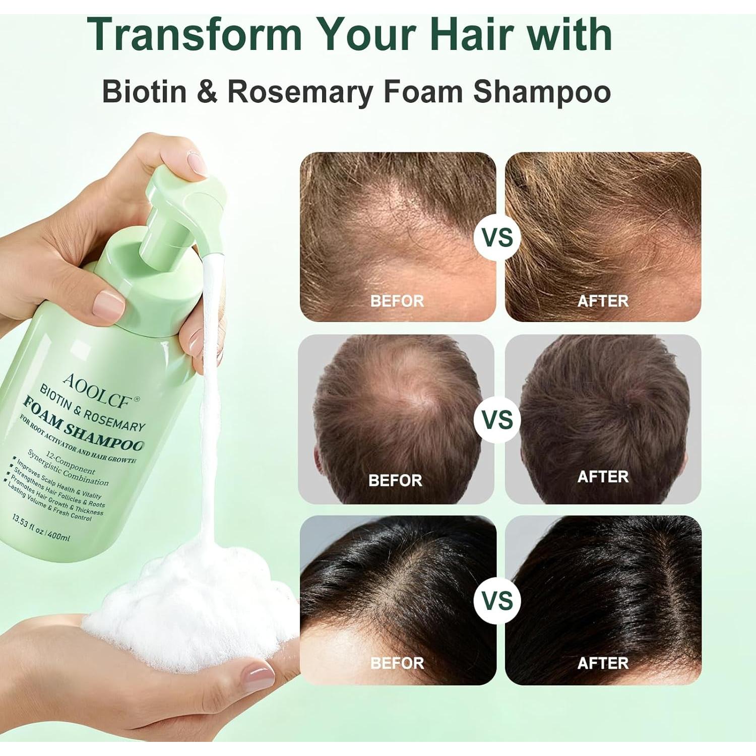 Champú Biotina y Romero AOOLCF 400 ml - Crecimiento Cabello