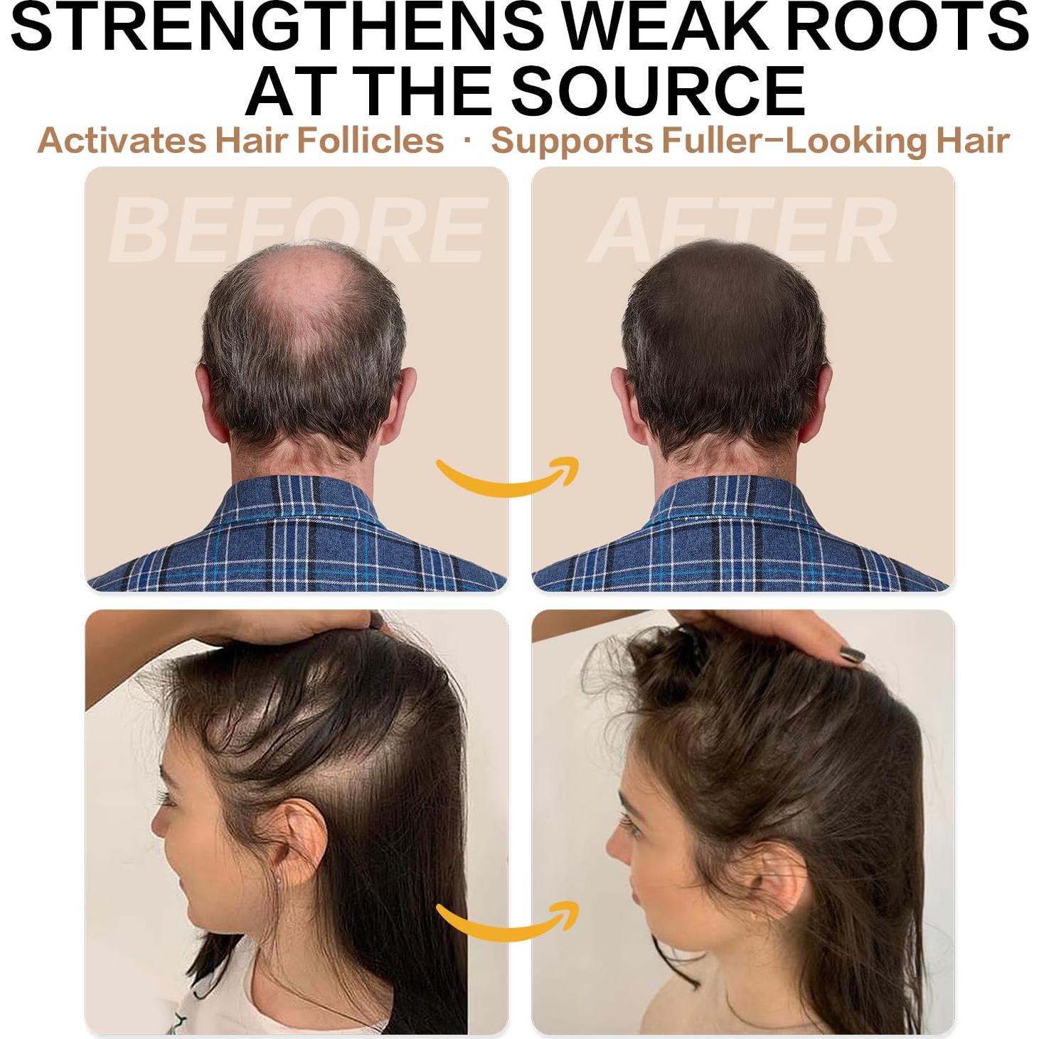 Champú Activador de Raíces PHARMBANNER 300 ml - Crecimiento Capilar