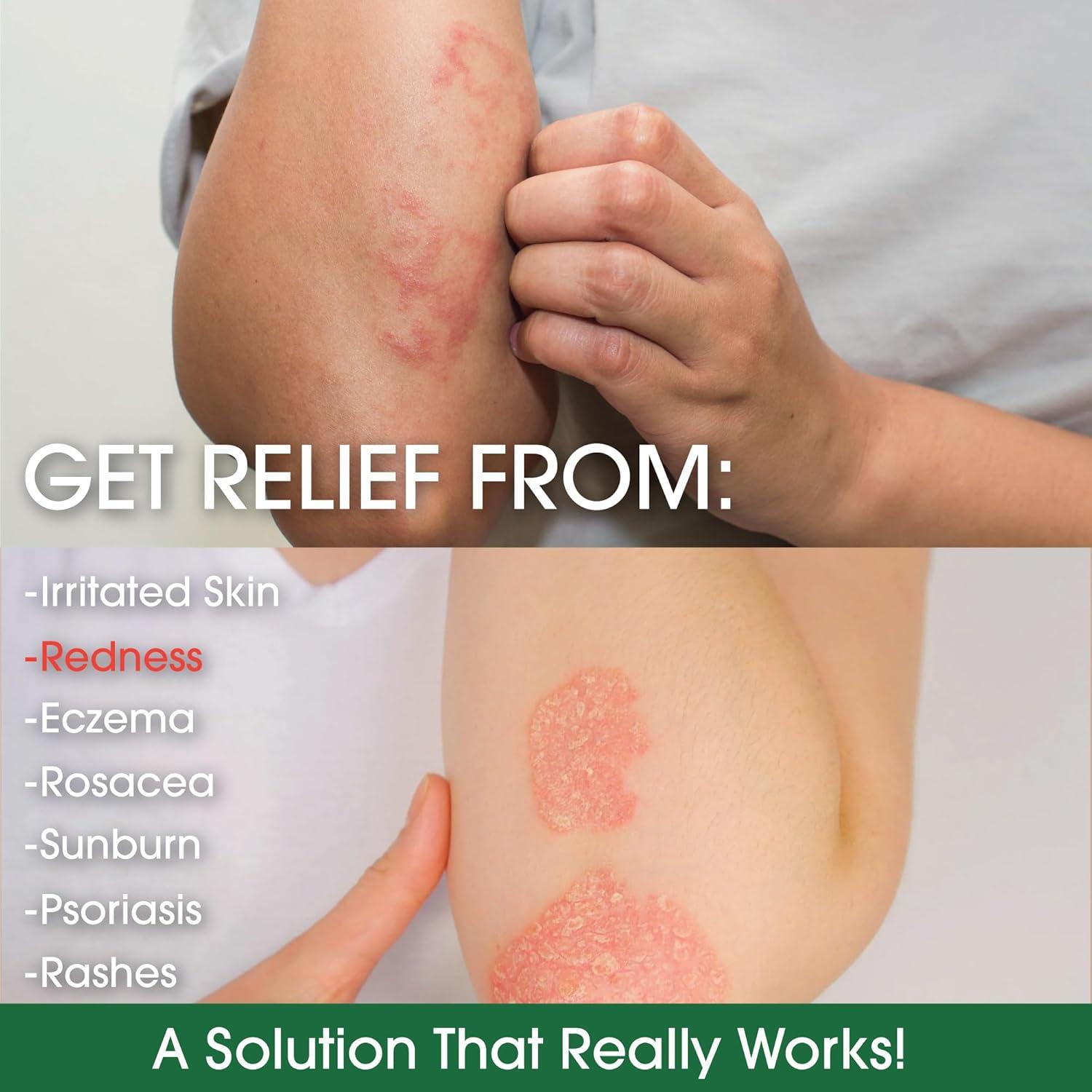 Crema Hidratante Sin Fragancia Green Leaf 453g Eczema Psoriasis