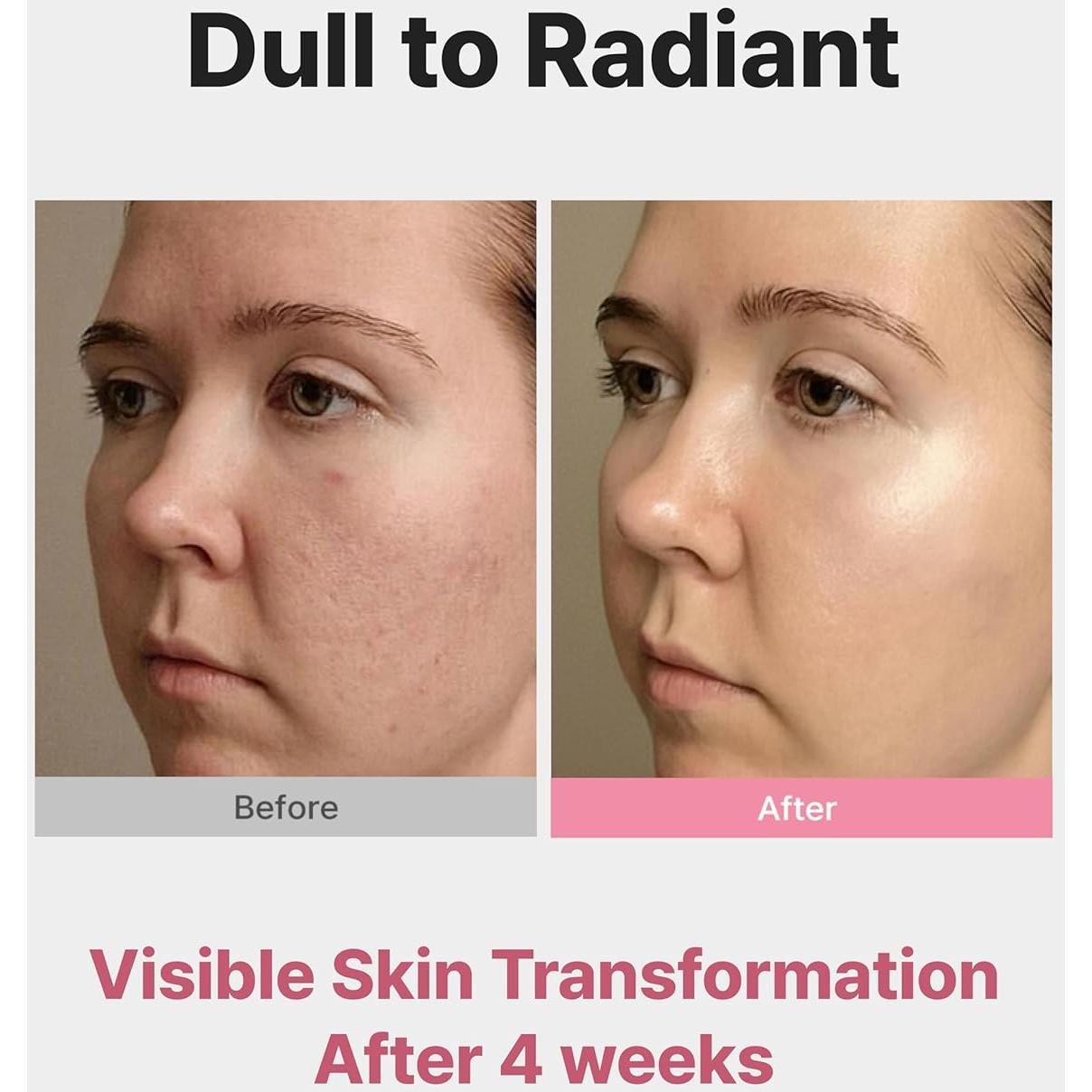 Tónico Exfoliante AHA 3% Delere con Colágeno 250ml