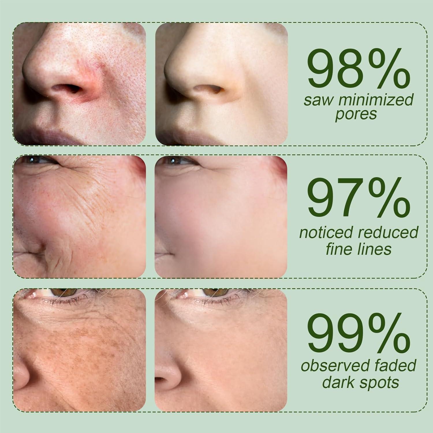 Discos de Tónico Coreano PuritieEv con Mucina de Caracol - 100 Unidades