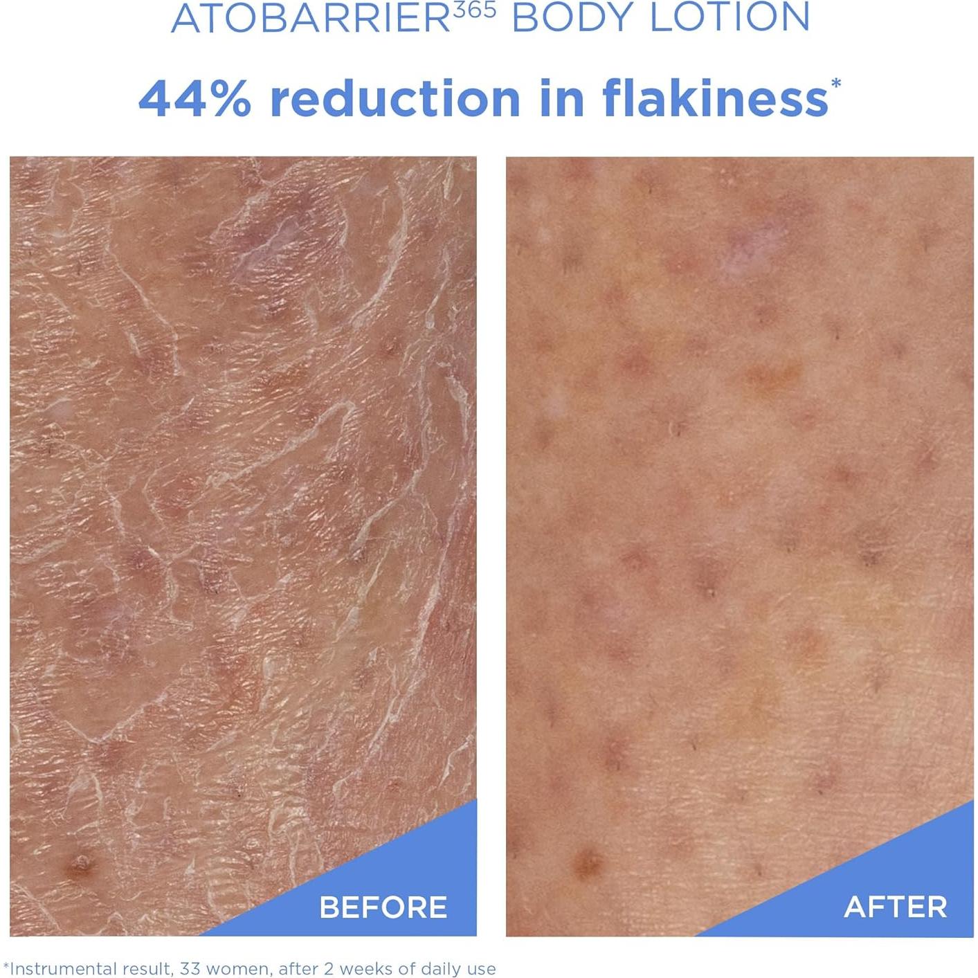 Loción Corporal AESTURA ATOBARRIER365 con Ceramidas 400 mL