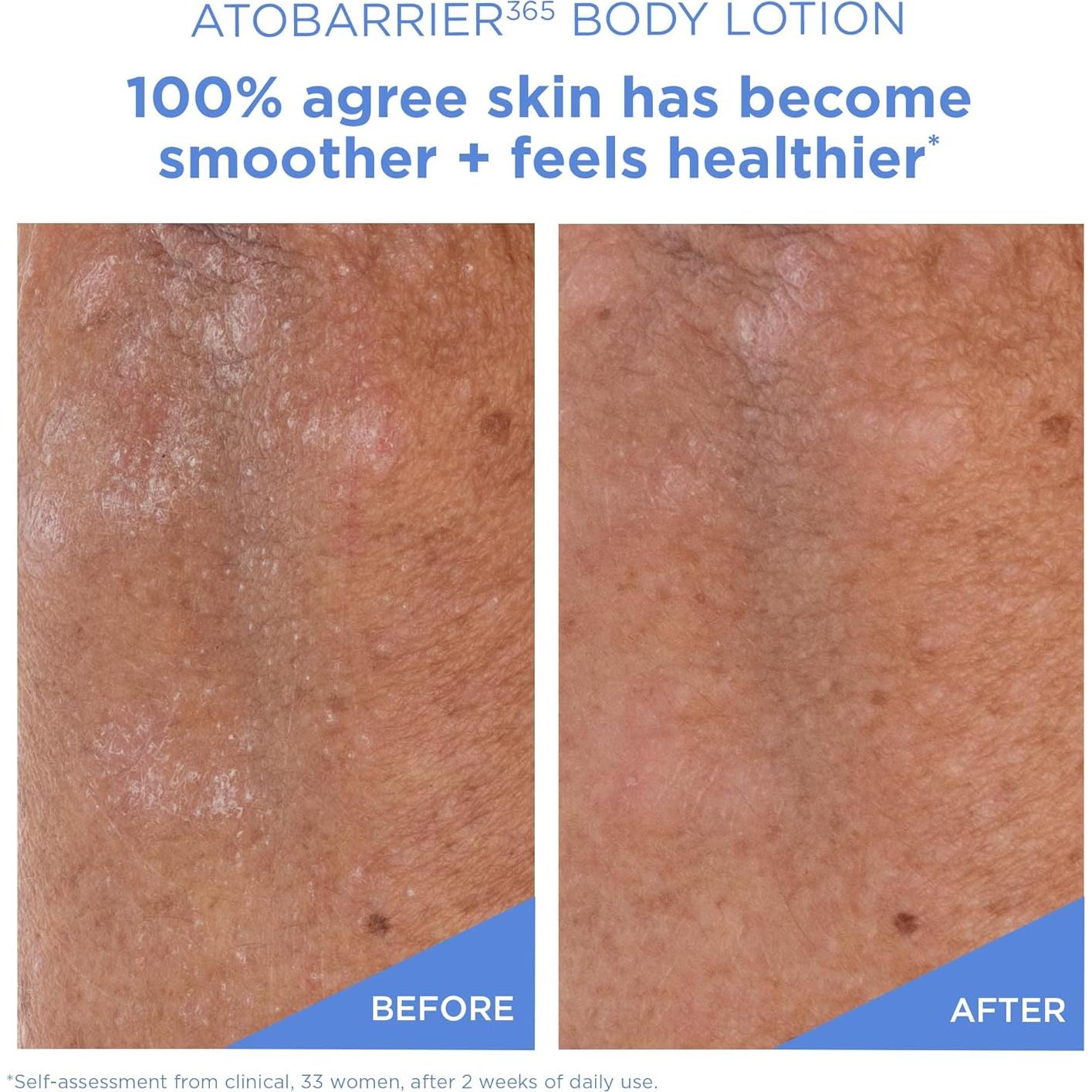 Loción Corporal AESTURA ATOBARRIER365 con Ceramidas 400 mL