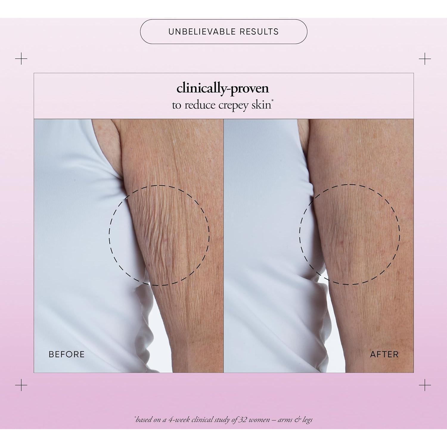 Suero Corporal Philosophy - Retinol, Ácido Hialurónico 192.5 ml