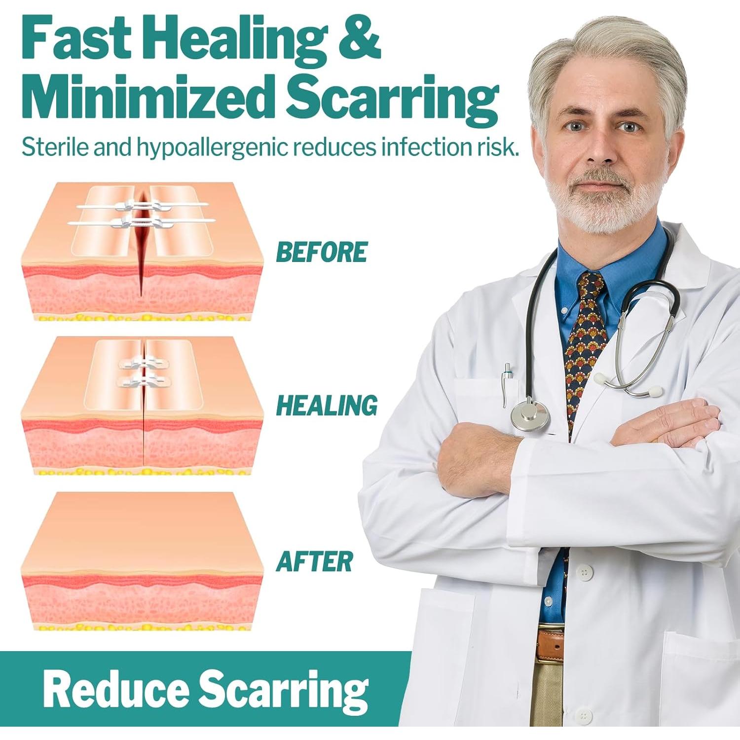 Kit de Cierre de Heridas AZEN 28 Piezas Vendajes Mariposa