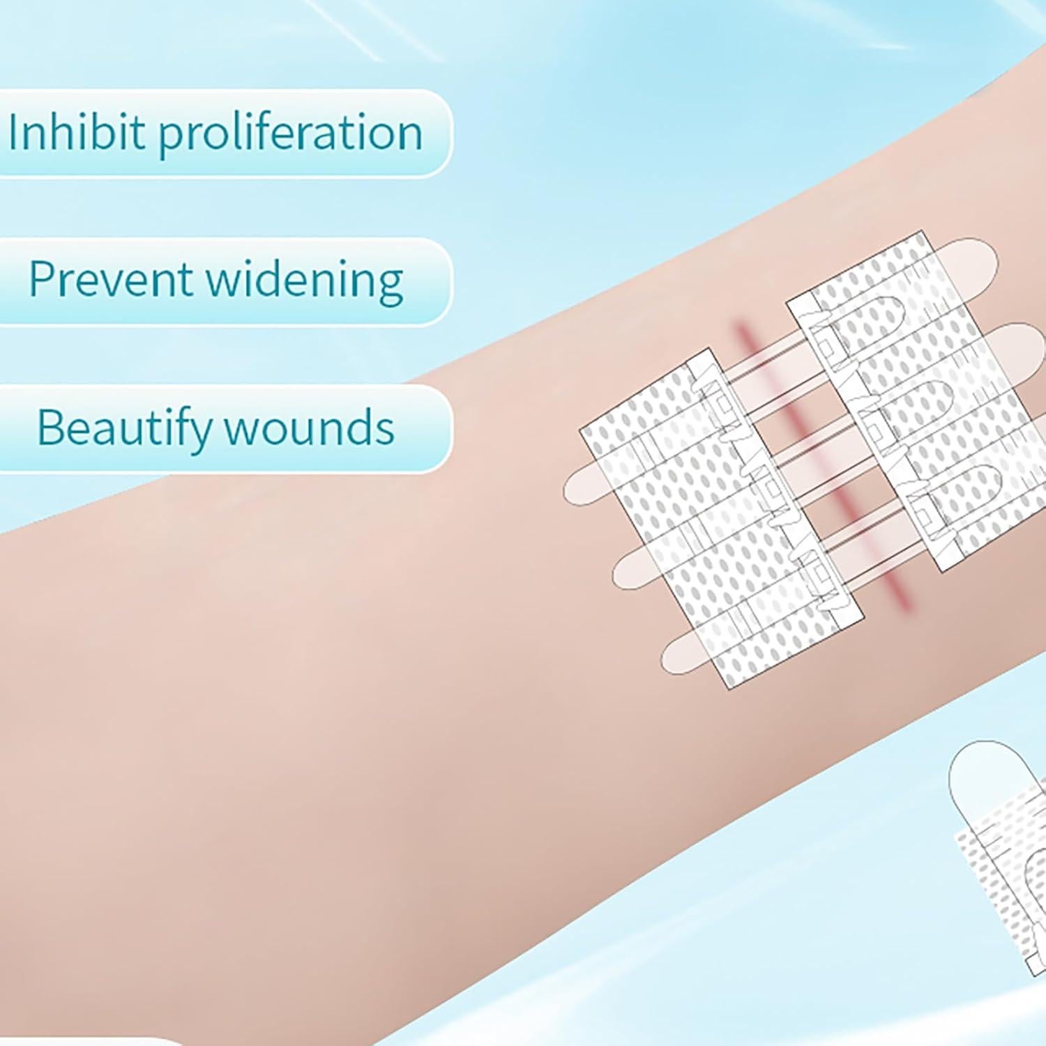 Kit de Cierre de Heridas Mariposa 6x8cm Vendas Autoadhesivas