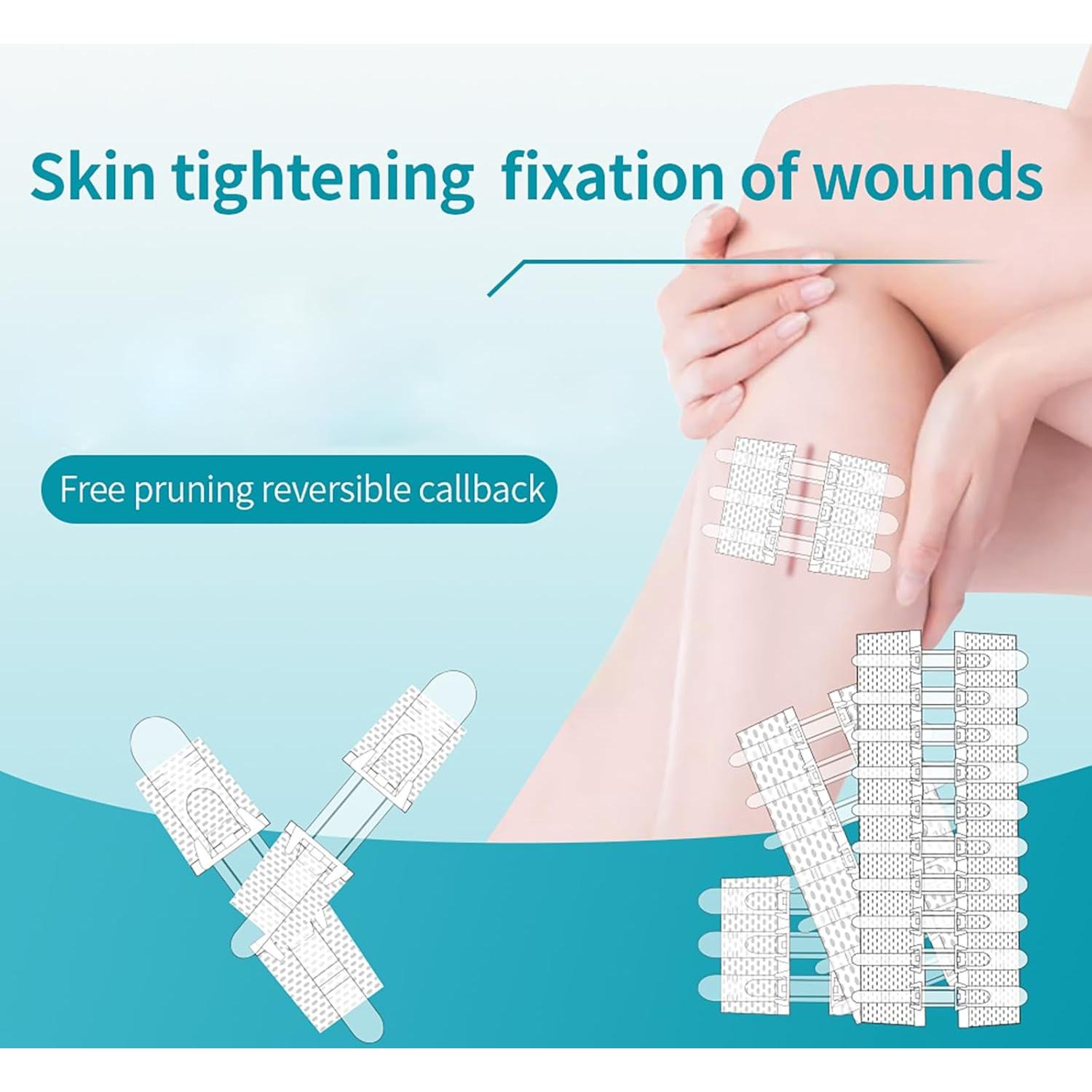 Kit de Cierre de Heridas Mariposa 6x8cm Vendas Autoadhesivas