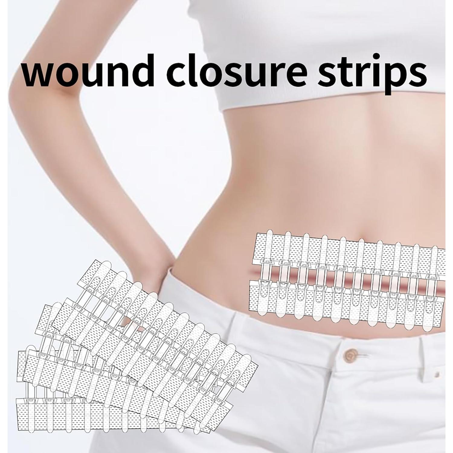 Kit de Cierre de Heridas Mariposa 6x8cm Vendas Autoadhesivas