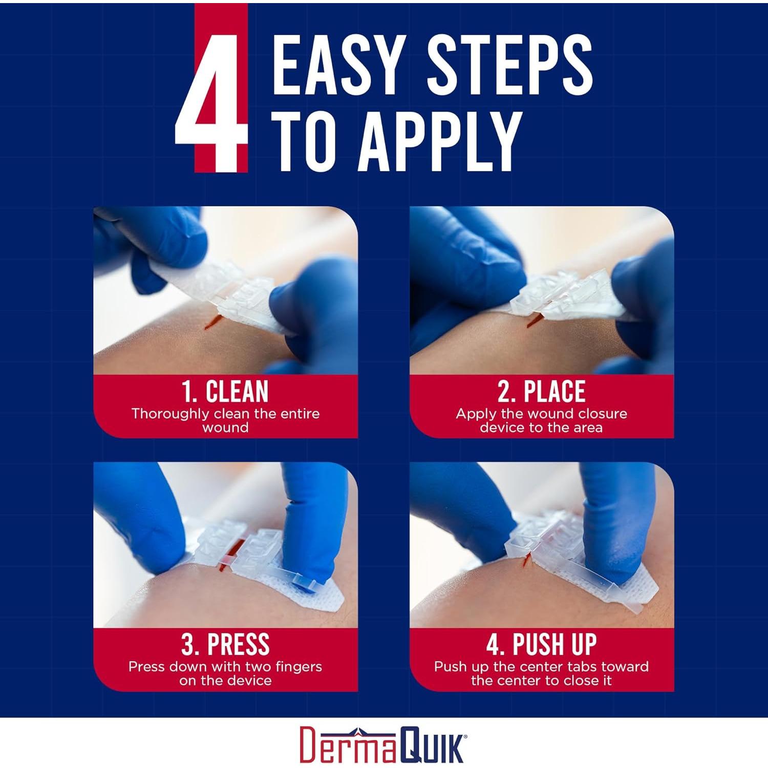 Tiras de Cierre de Heridas DermaQuik - Paquete de 3 Unidades